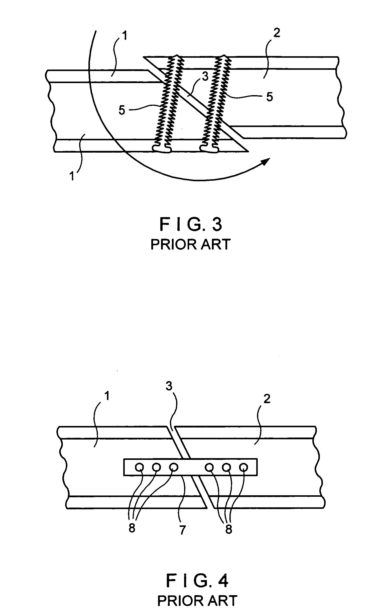 Bone fixation device and method