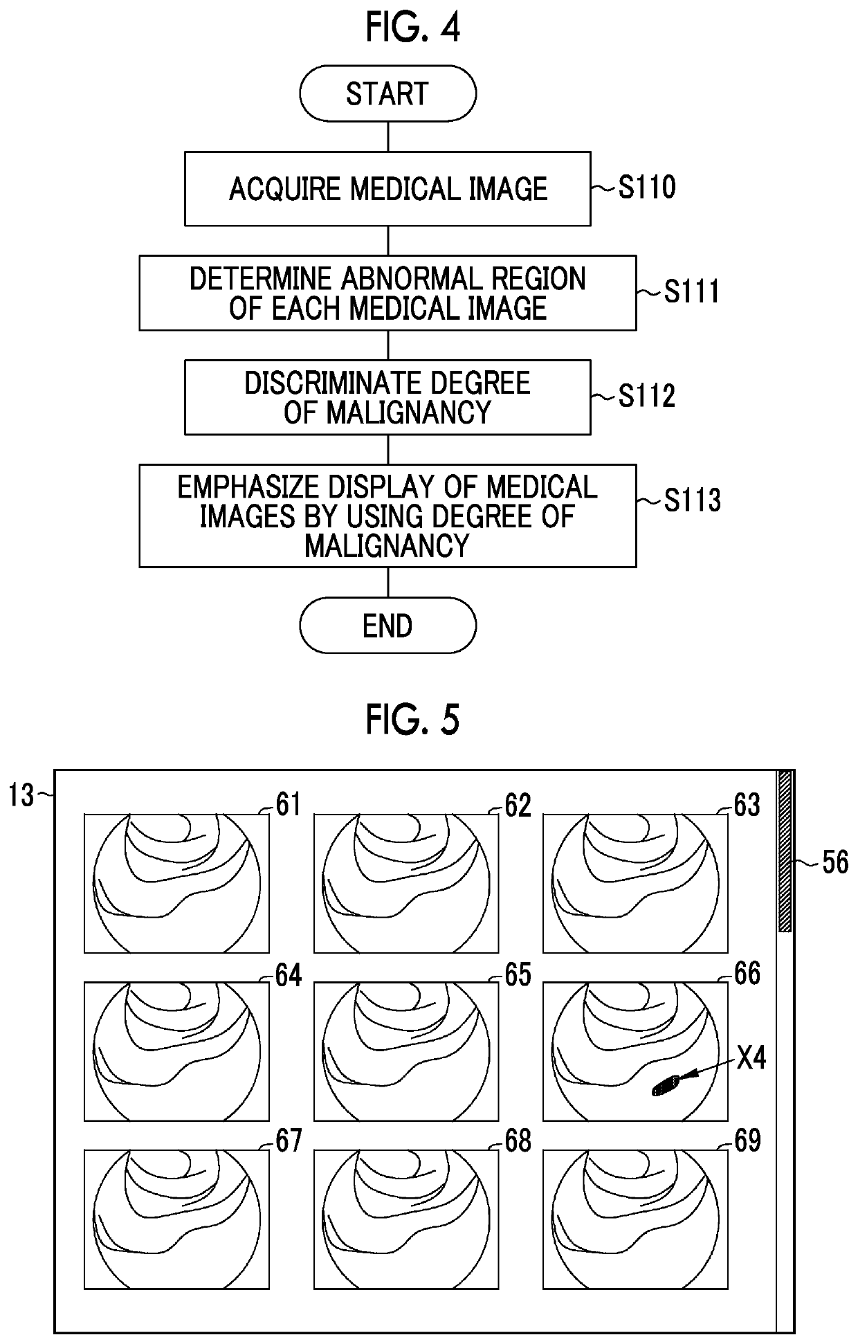 Medical image processing apparatus