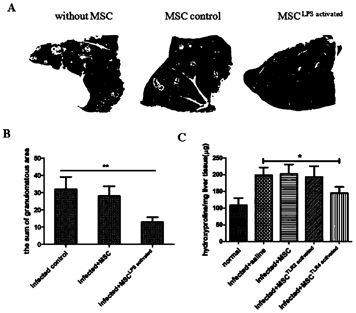 Mesenchymal stem cell treating method for Schistosoma japonicum infection treatment