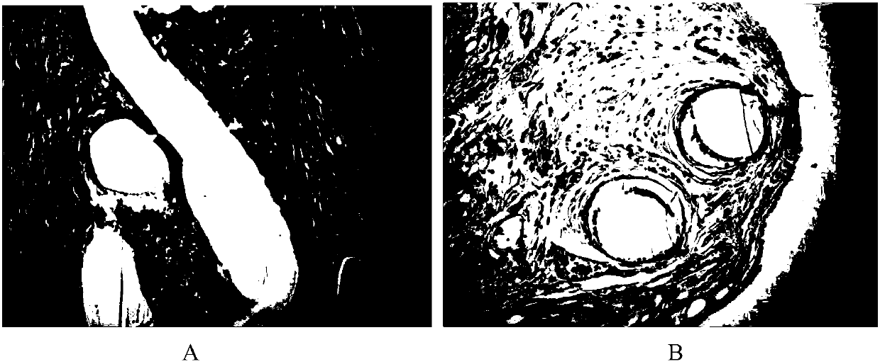 Preparation method and product of organic-inorganic core-sheath structure composite biomaterial