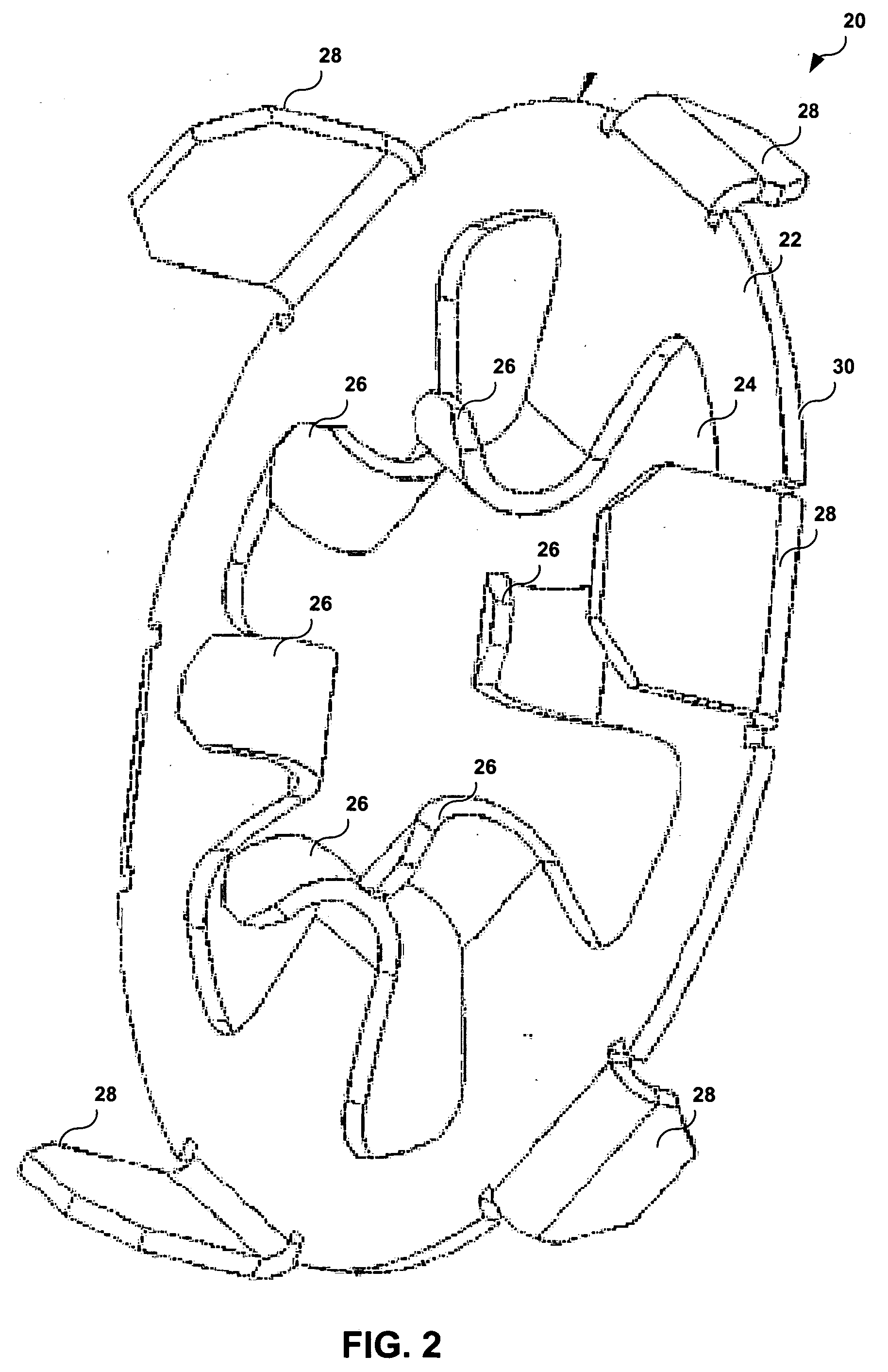 System and method of establishing an electrical connection between an implanted lead and an electrical contact