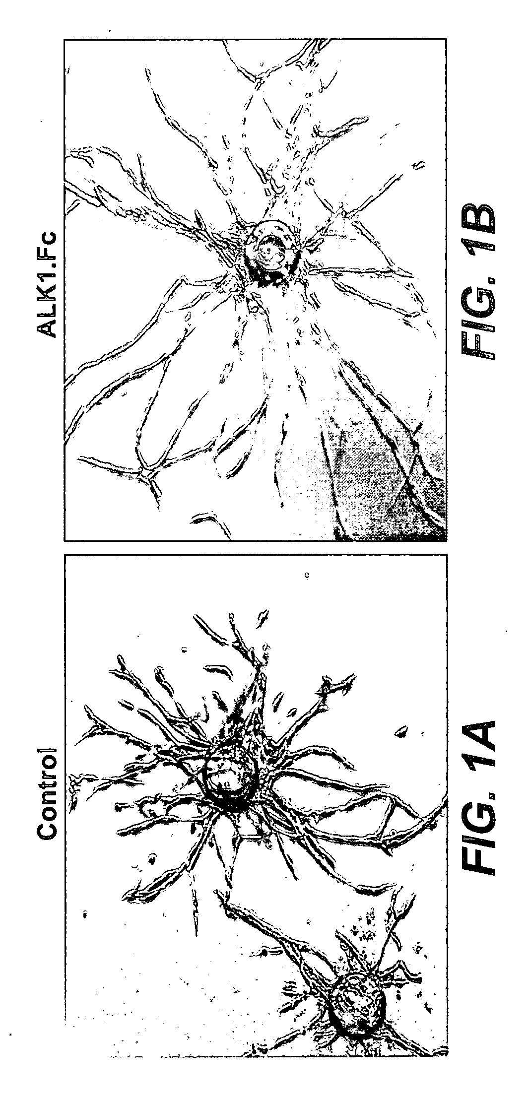 Activin receptor-like kinase-1 compositions and methods of use