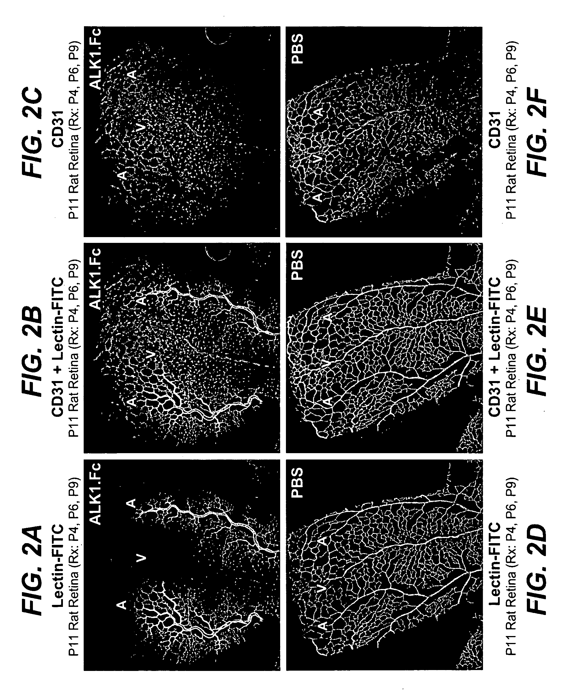 Activin receptor-like kinase-1 compositions and methods of use