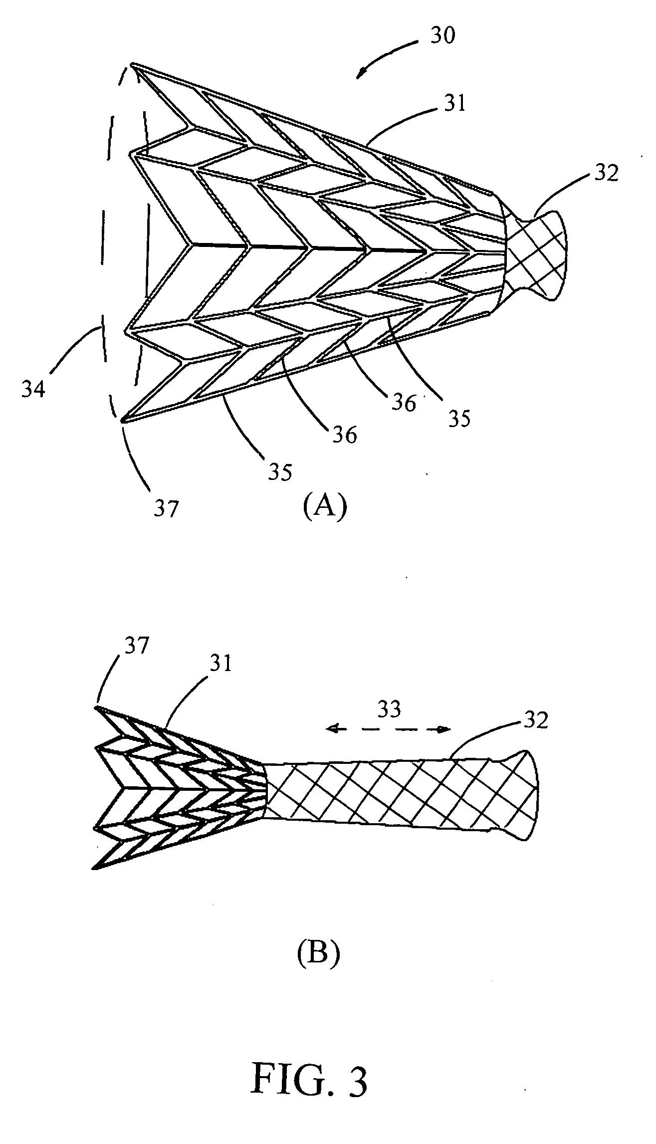 Breast augmentation system