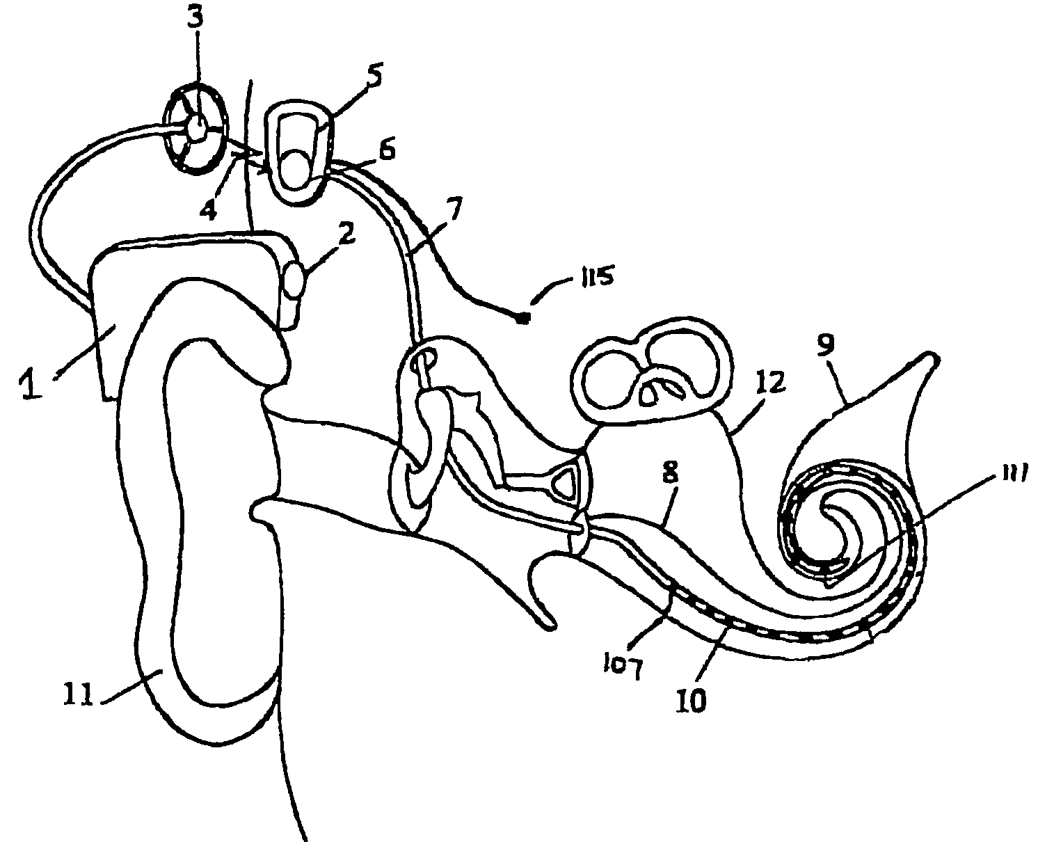 Peak-derived timing stimulation strategy for a multi-channel cochlear implant