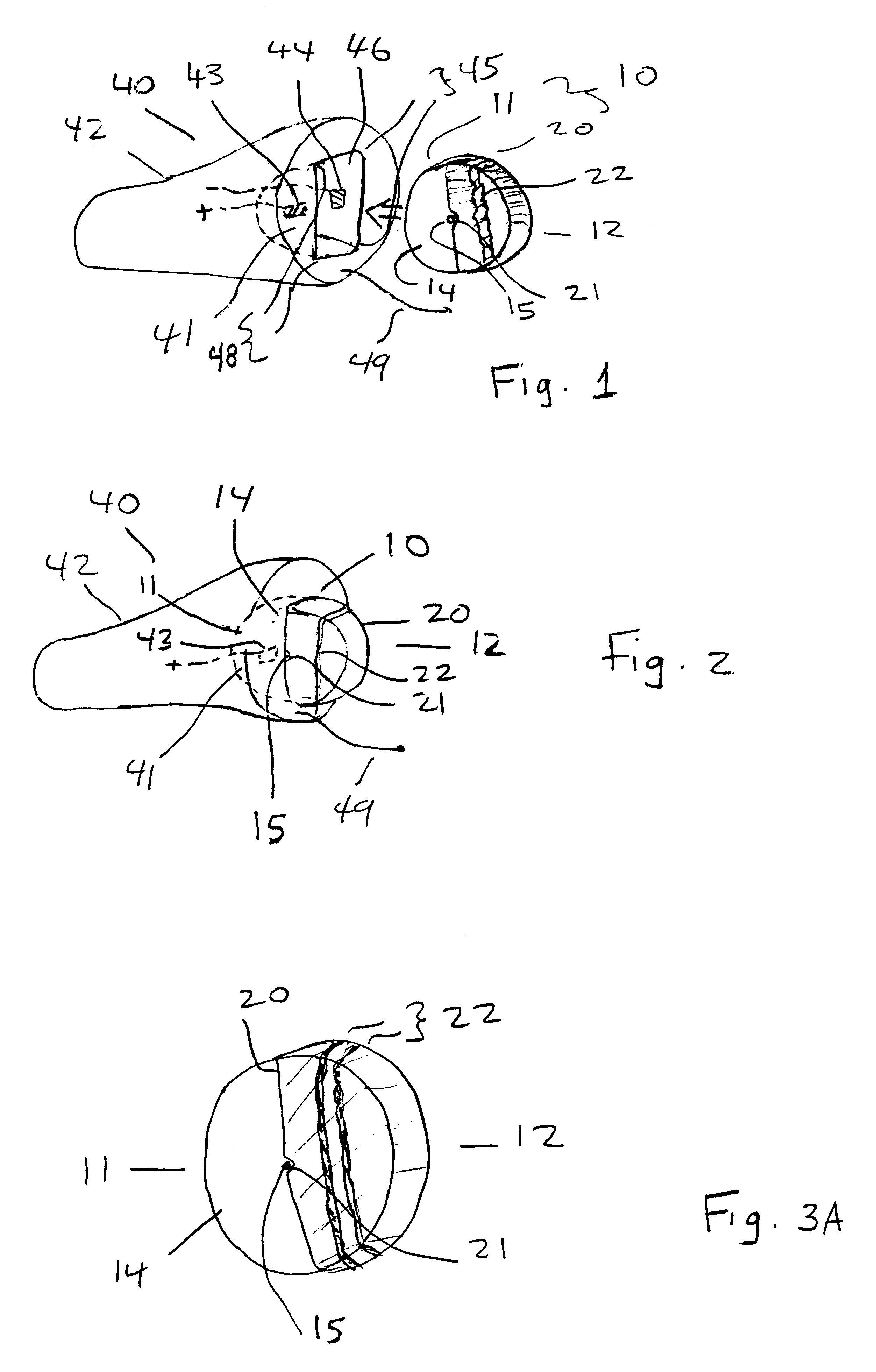 Hearing device with protruding battery assembly