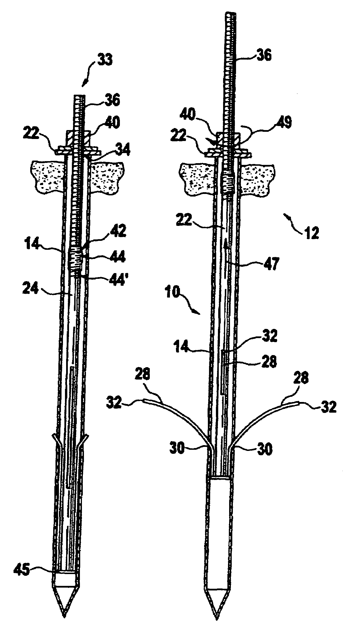 System for fixing an object in the ground by means of a peg