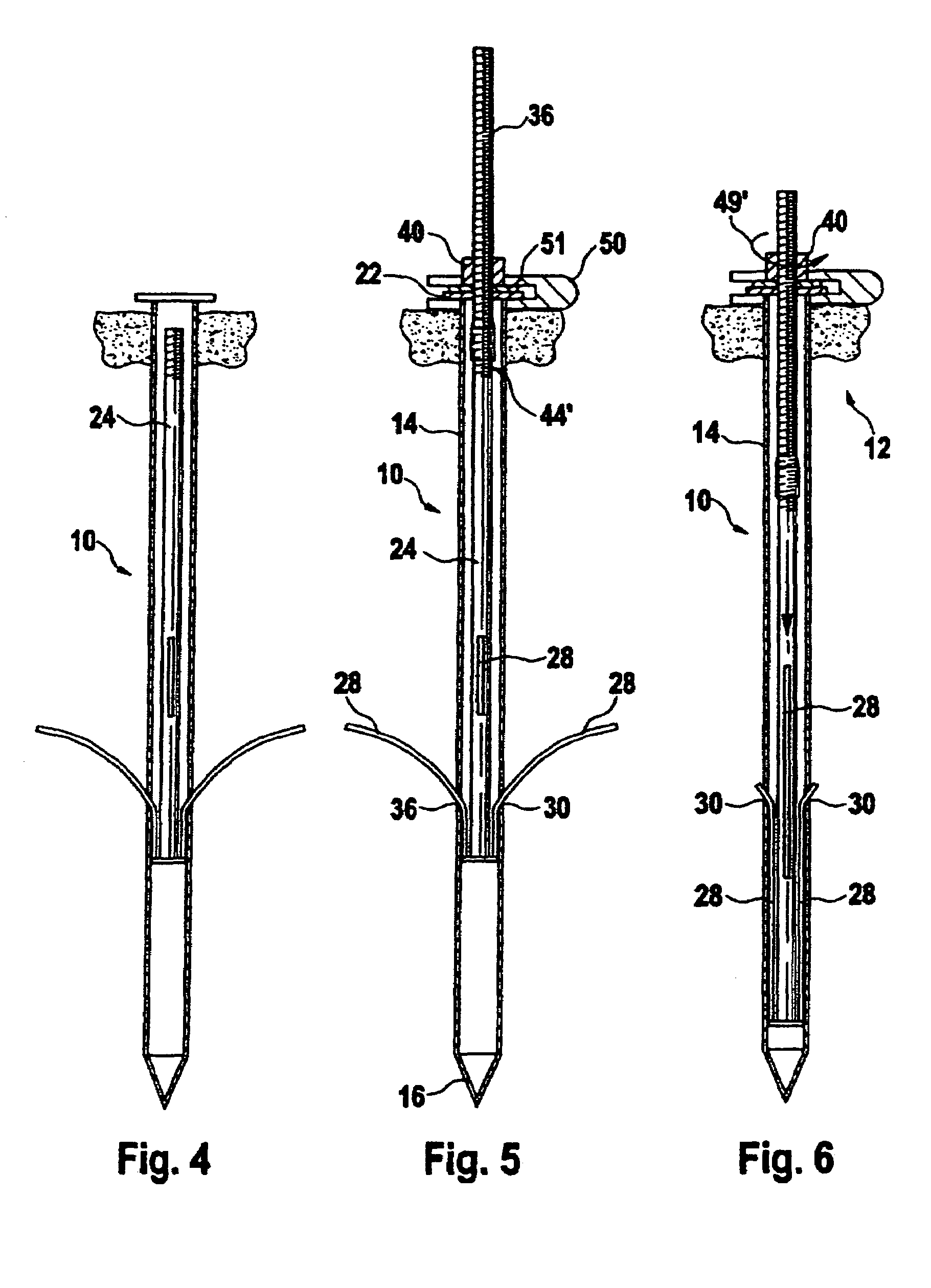 System for fixing an object in the ground by means of a peg