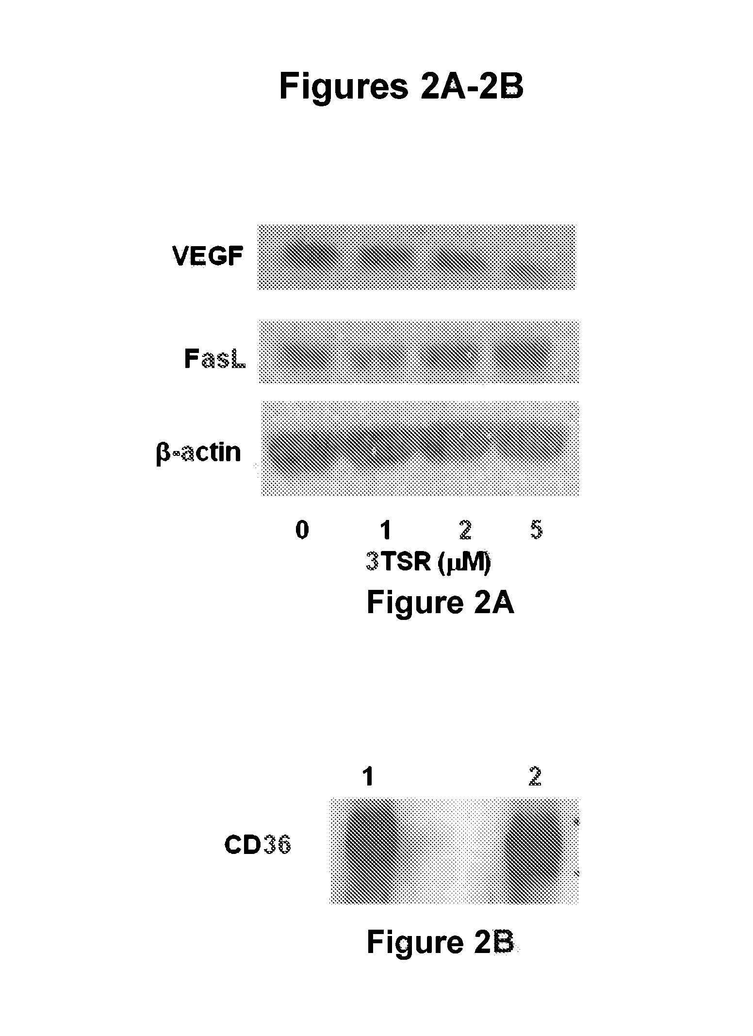 Thrombospondin-1 polypeptides and methods of using same