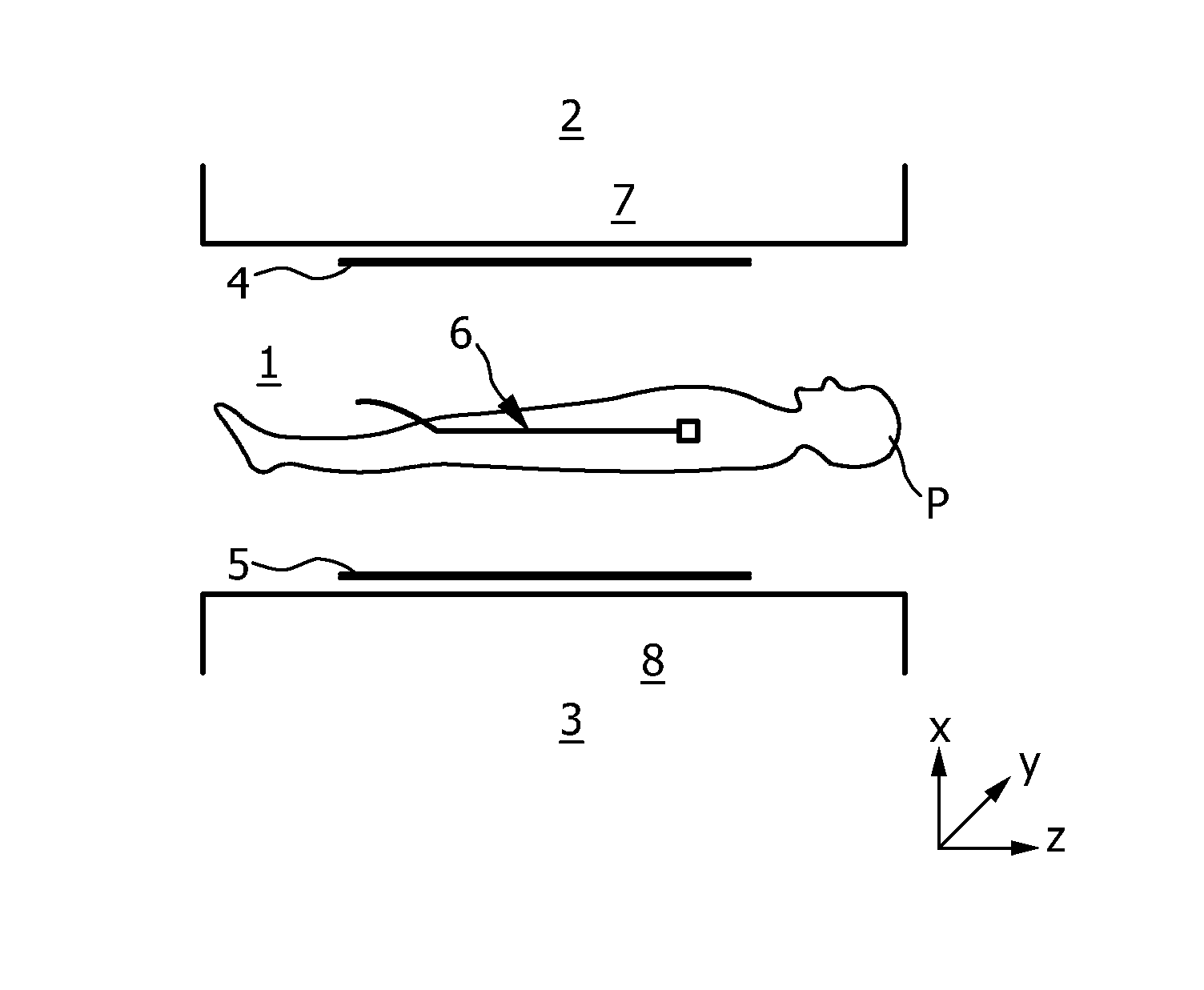 Catheter and medical assembly