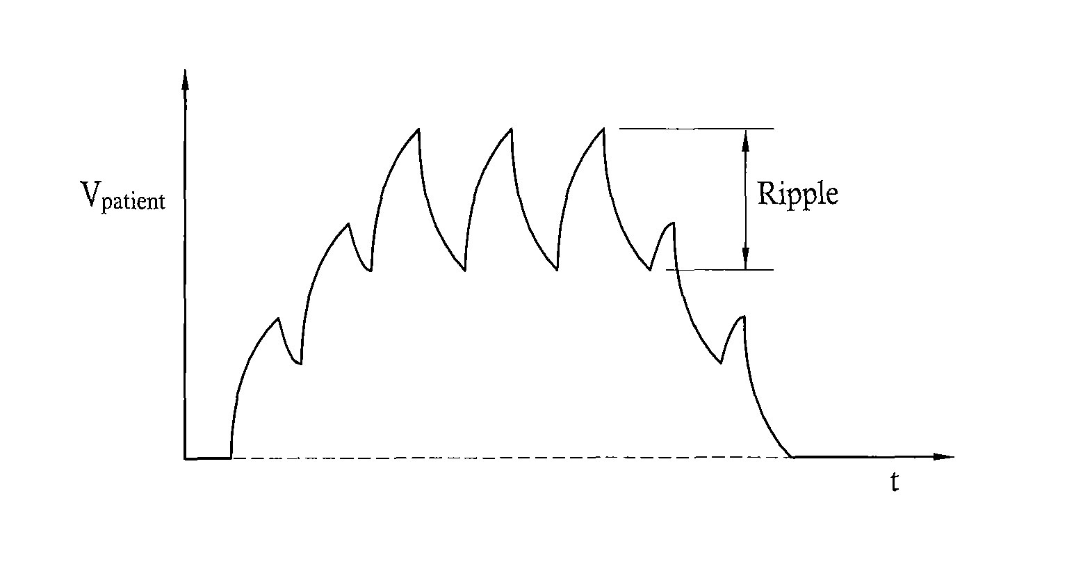 System to create arbitrary waveforms using an external inductor and an implantable medical device