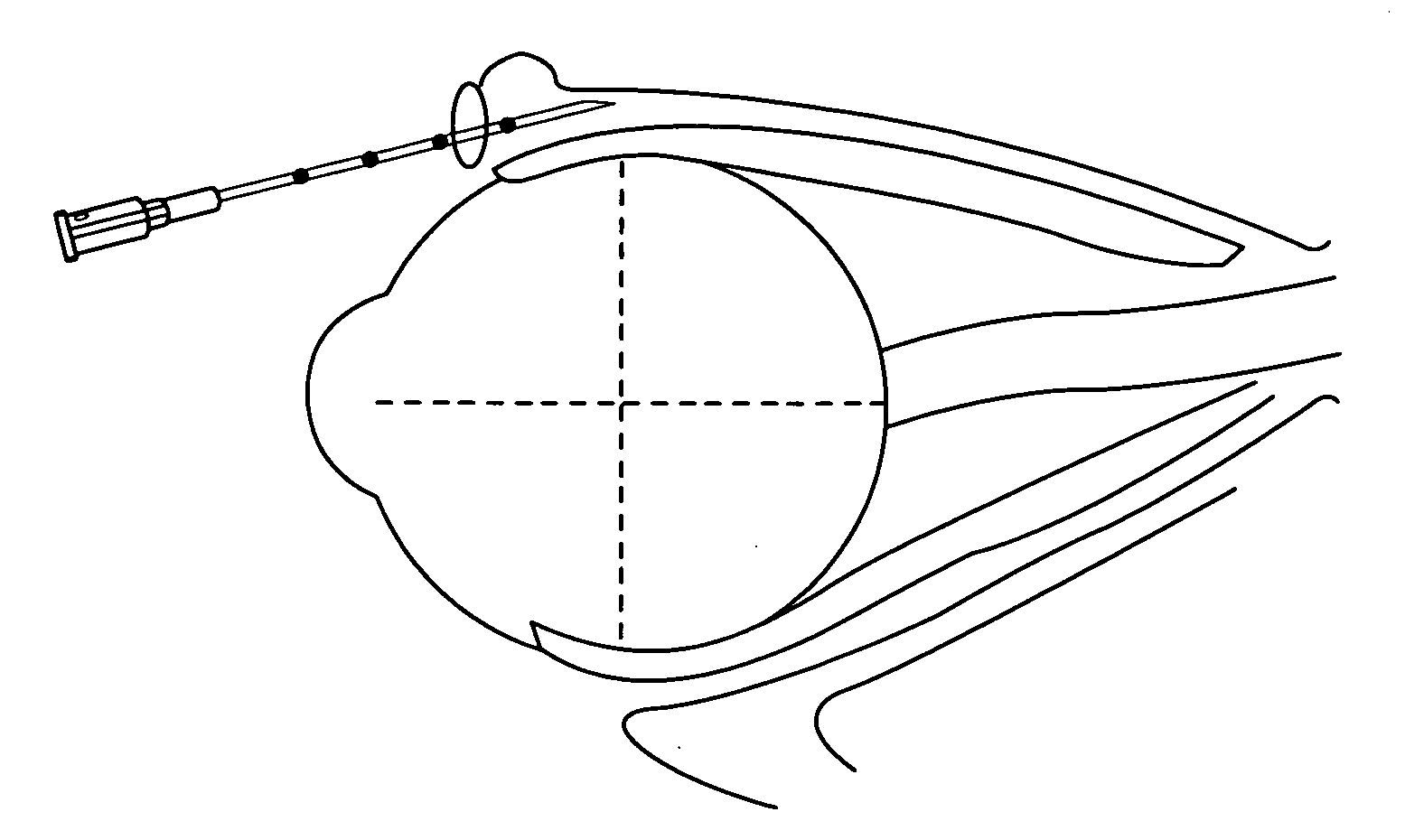 Insertion mechanism for use with a syringe