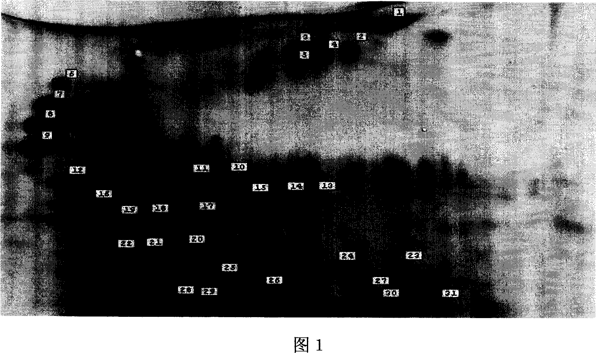 Earthworm protein EP-2 and its separation method and uses