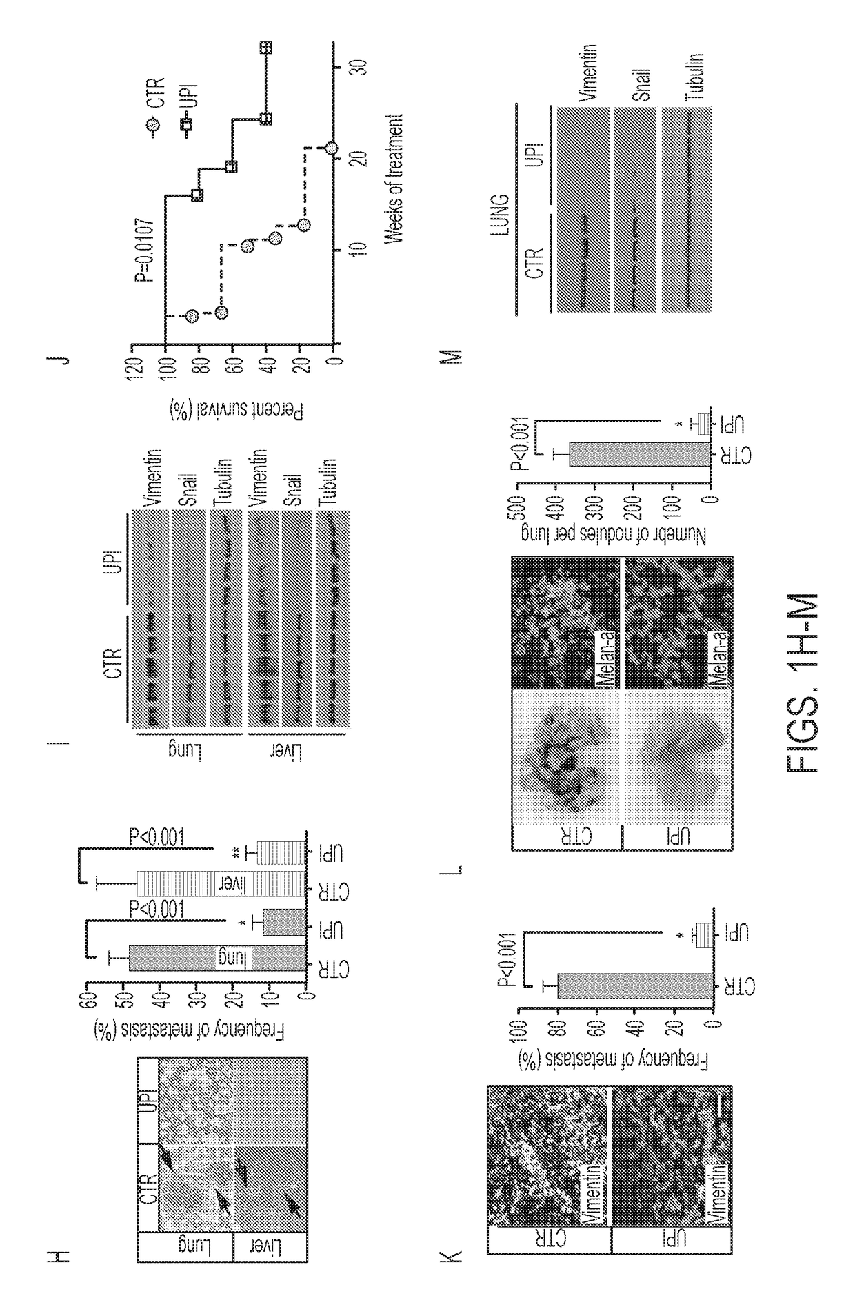 Ubiquitin interacting motif peptides as therapeutics