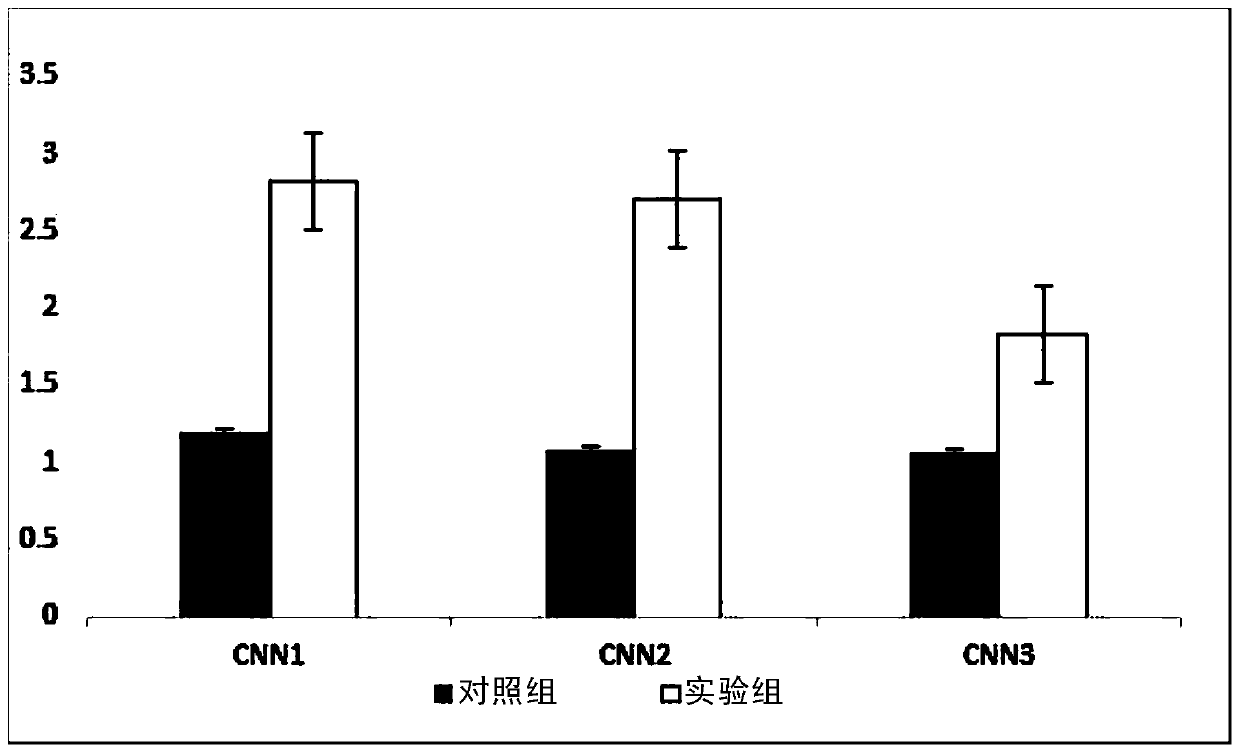 Application of Calponin-h2 (CNN2) as marker for diagnosing ectopic pregnancy