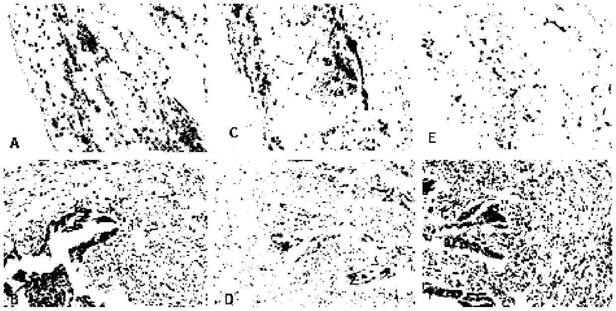 Application of Calponin-h2 (CNN2) as marker for diagnosing ectopic pregnancy