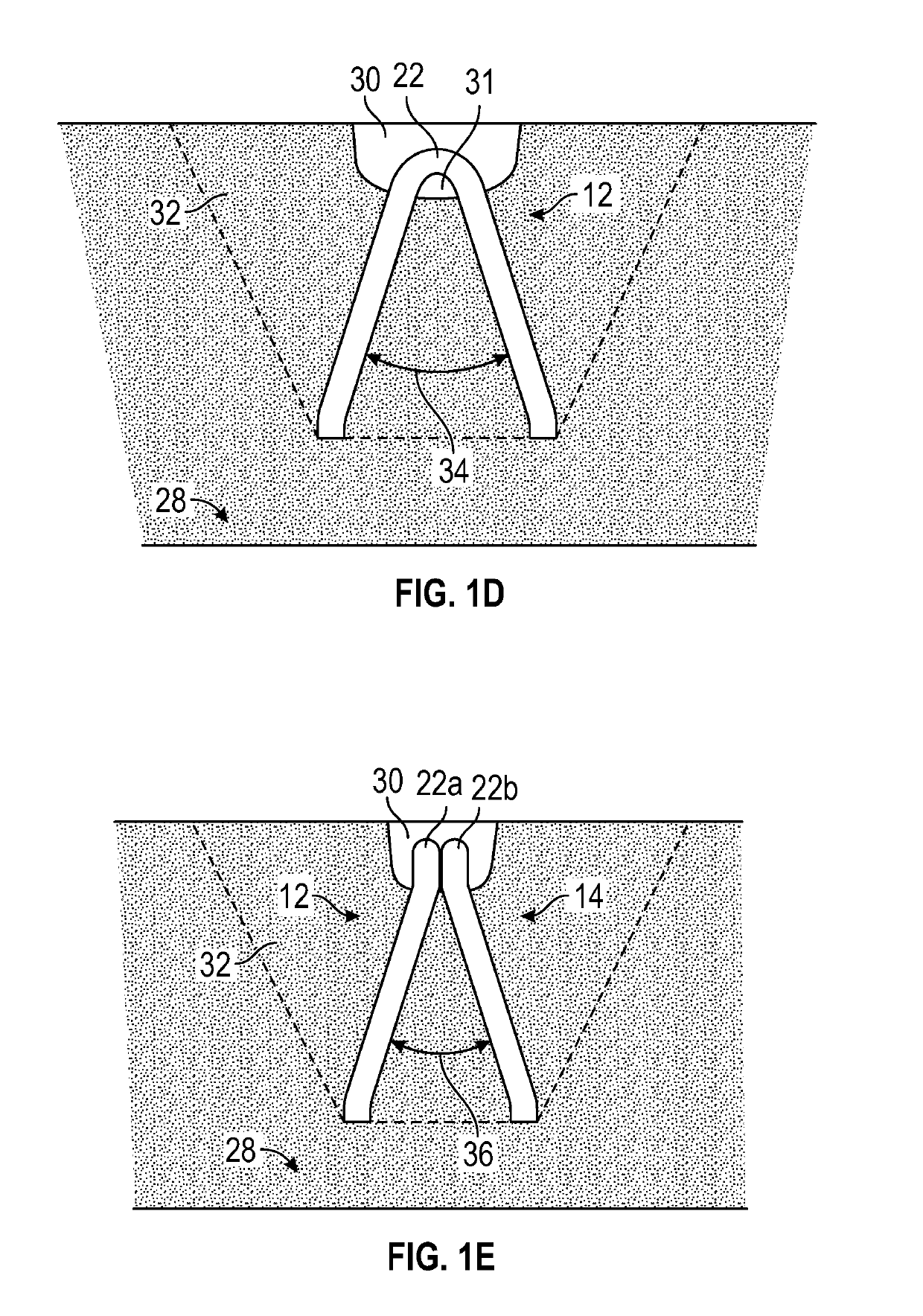 Anchor and clutch assembly