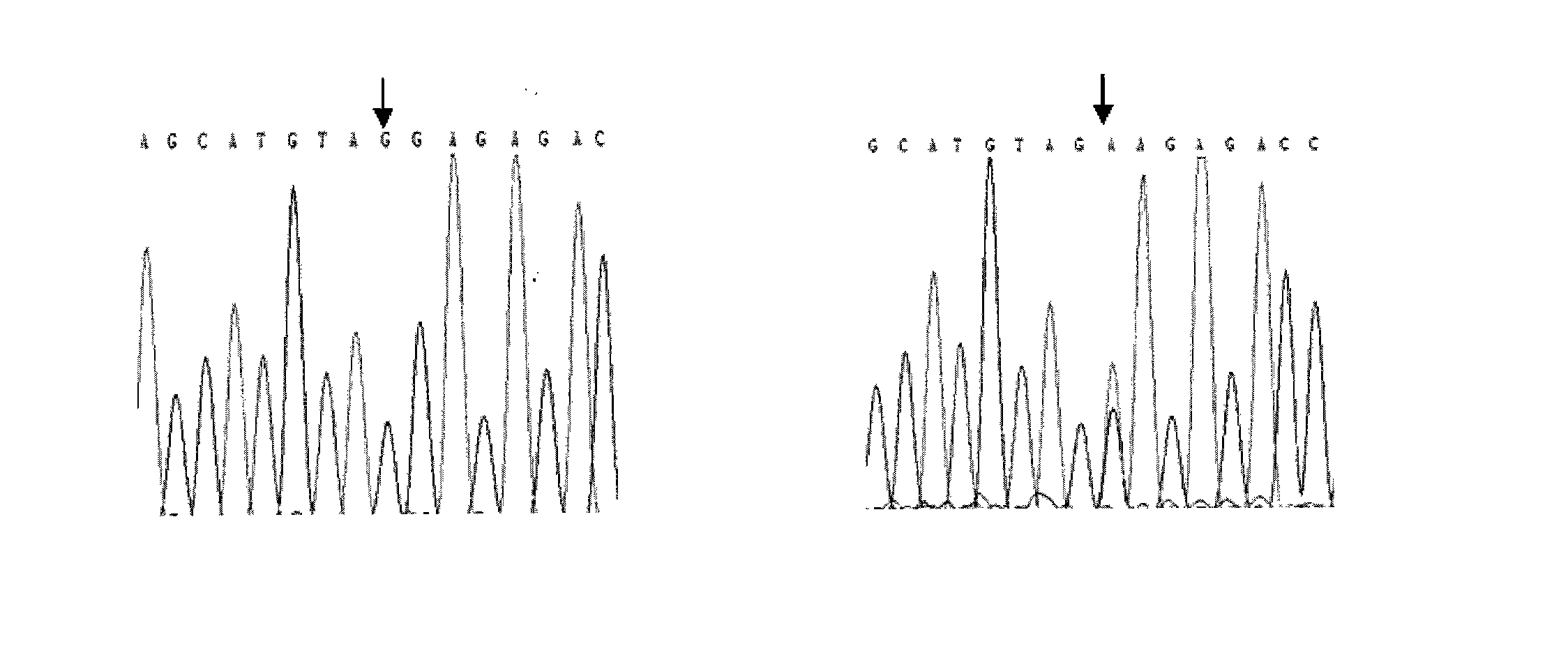 Method and reagent for prediction of ankylosing spondylitis susceptibility