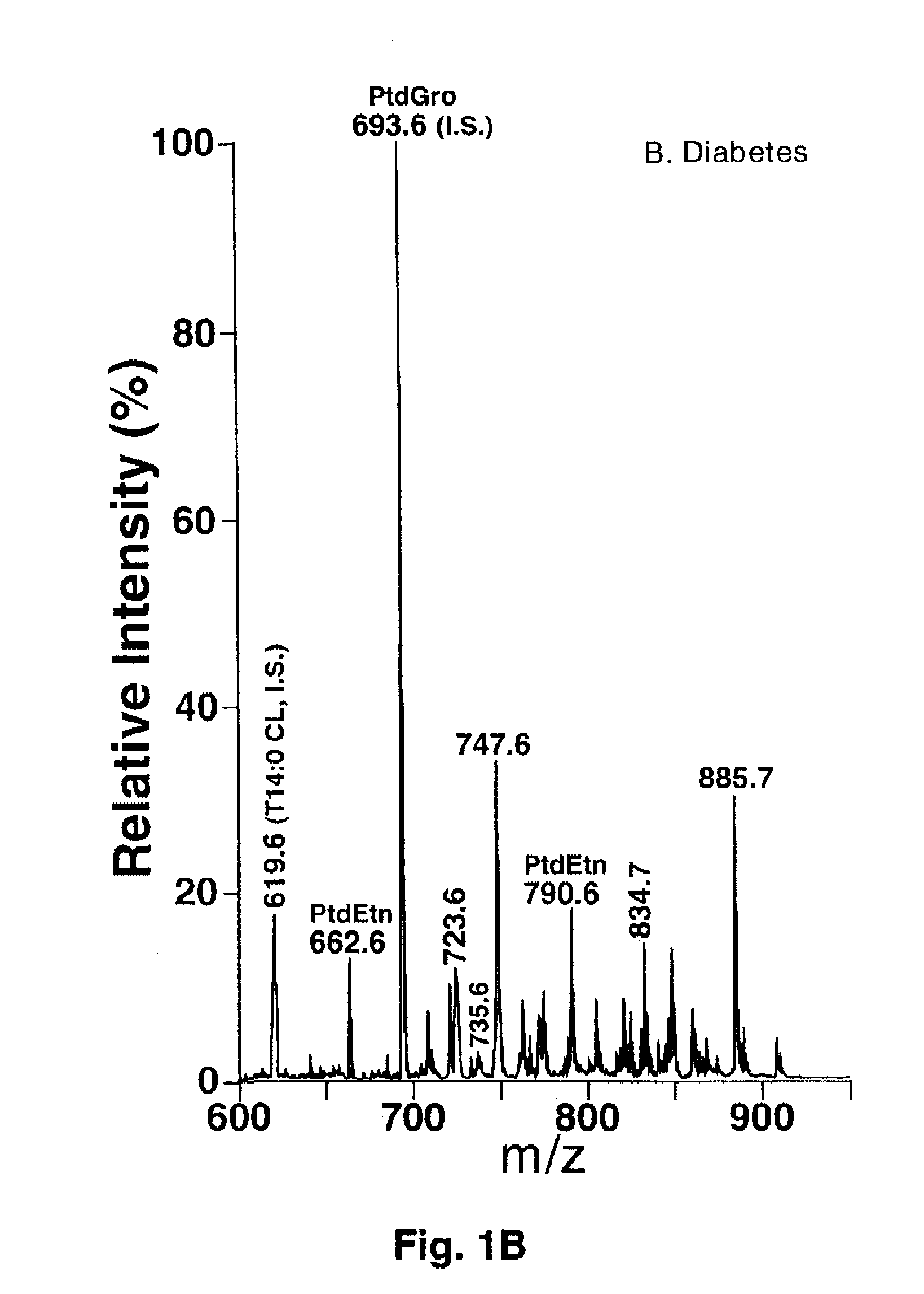 Enhanced medical treatment in diabetic cardiomyopathy