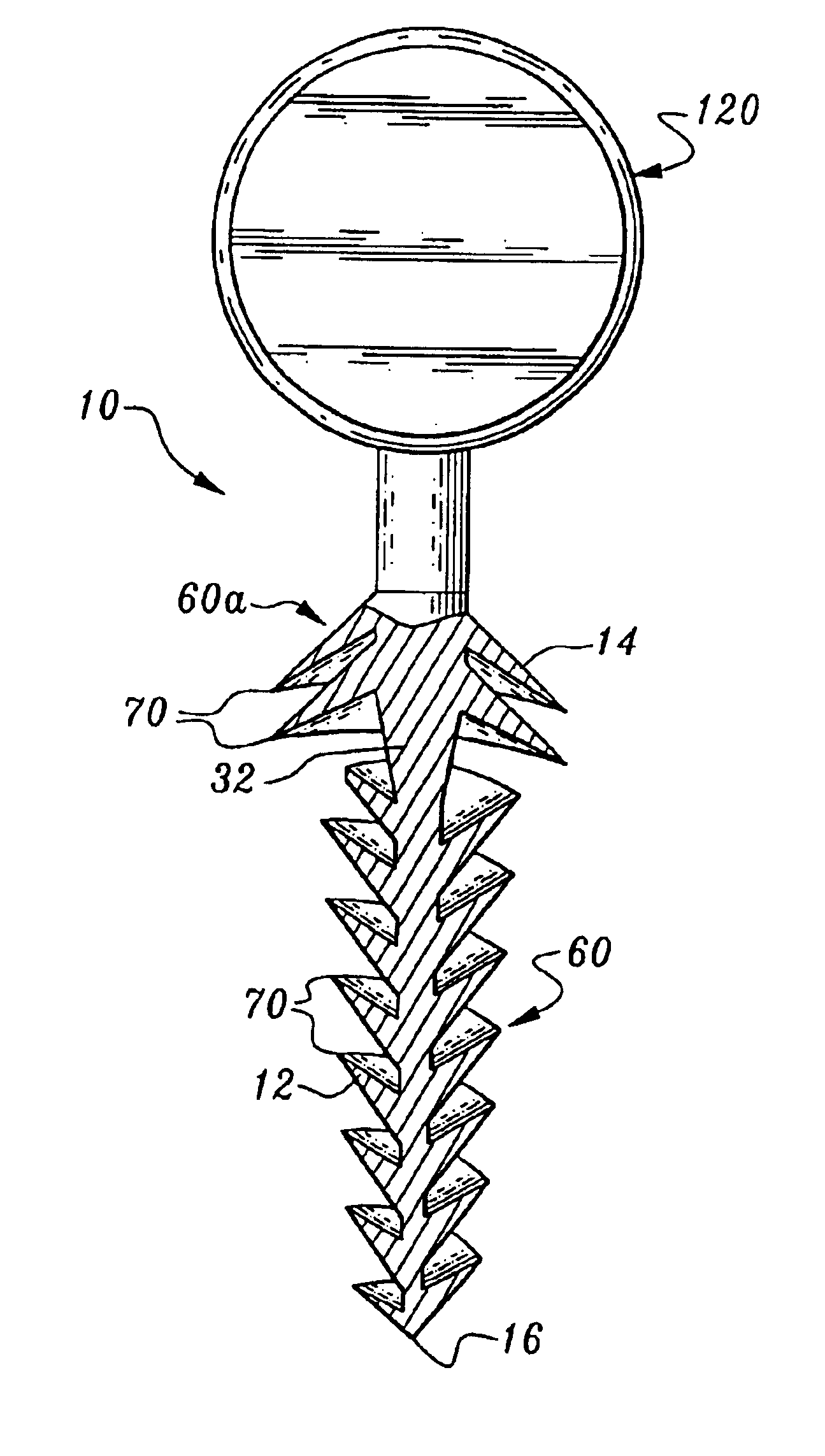 Orthopedic stabilization device and method