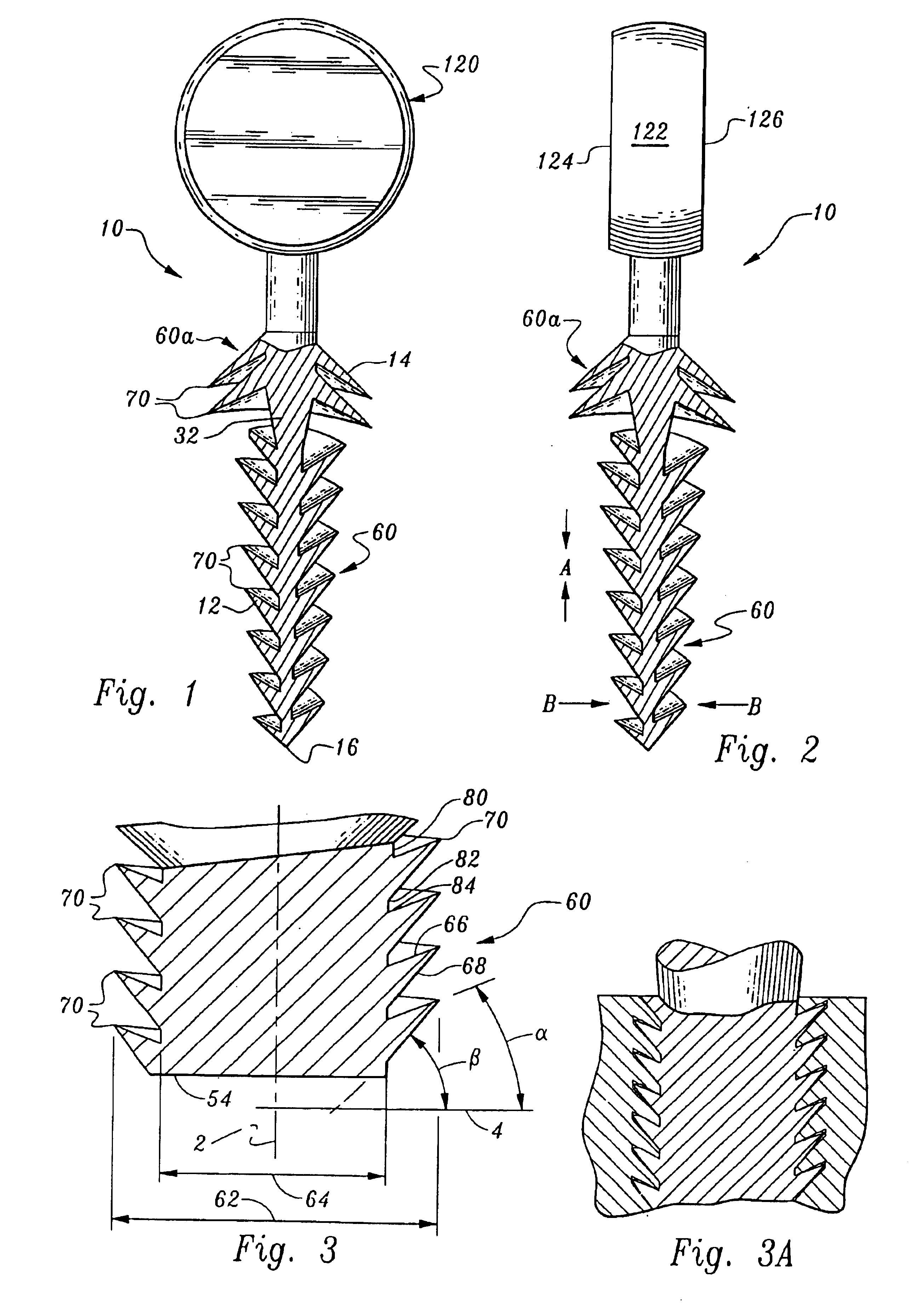 Orthopedic stabilization device and method