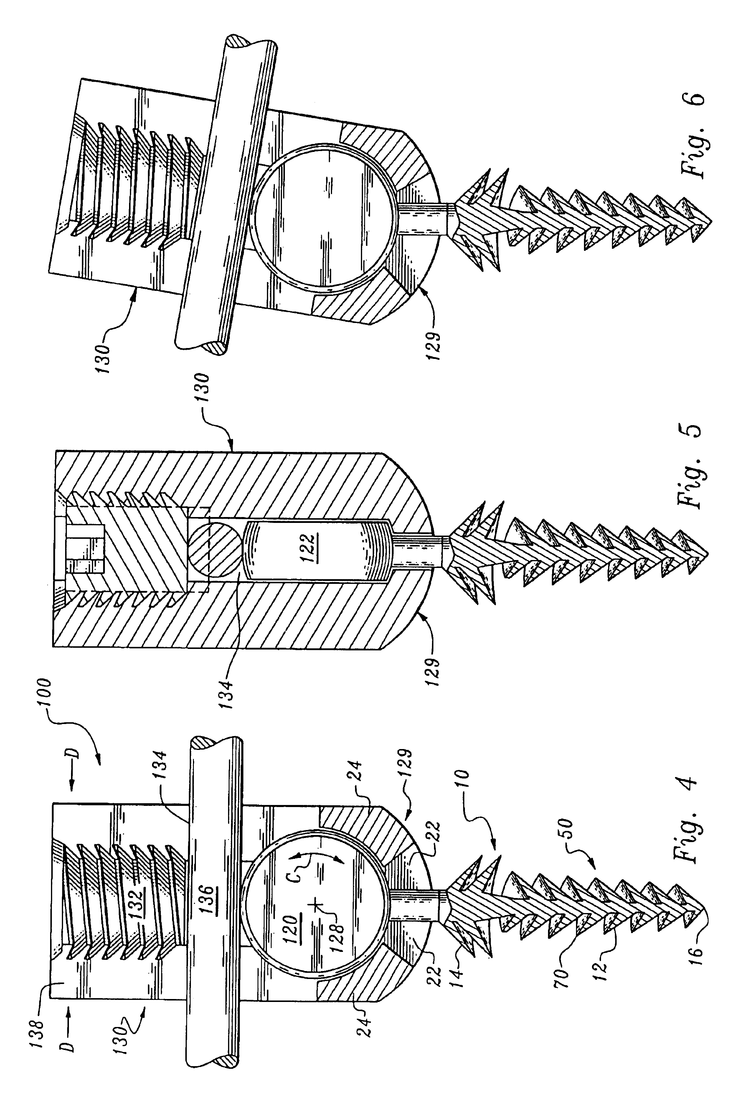 Orthopedic stabilization device and method