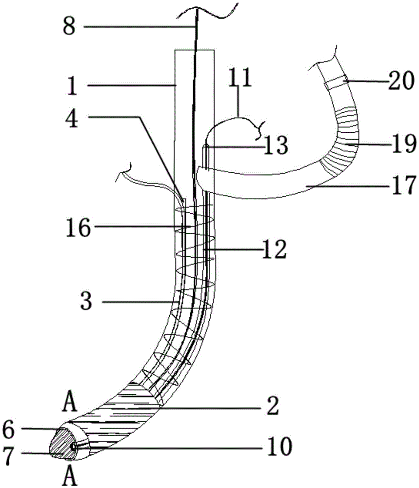 Novel trachea cannula