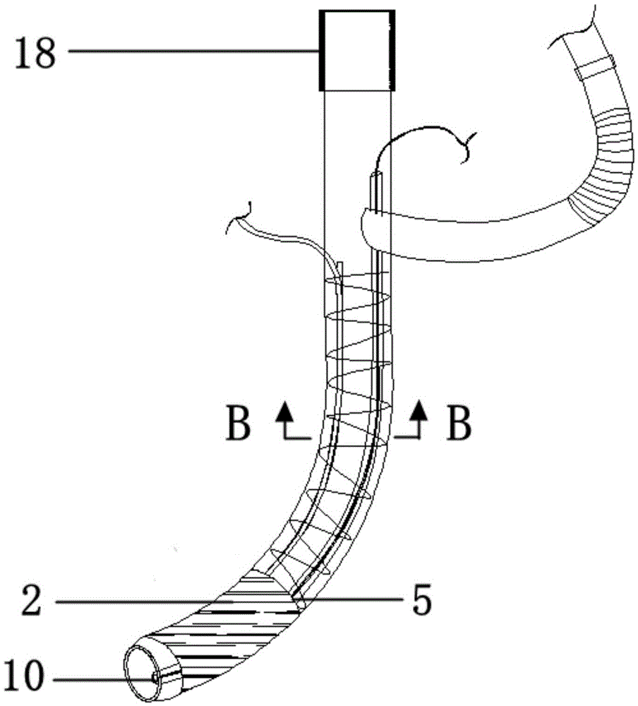 Novel trachea cannula