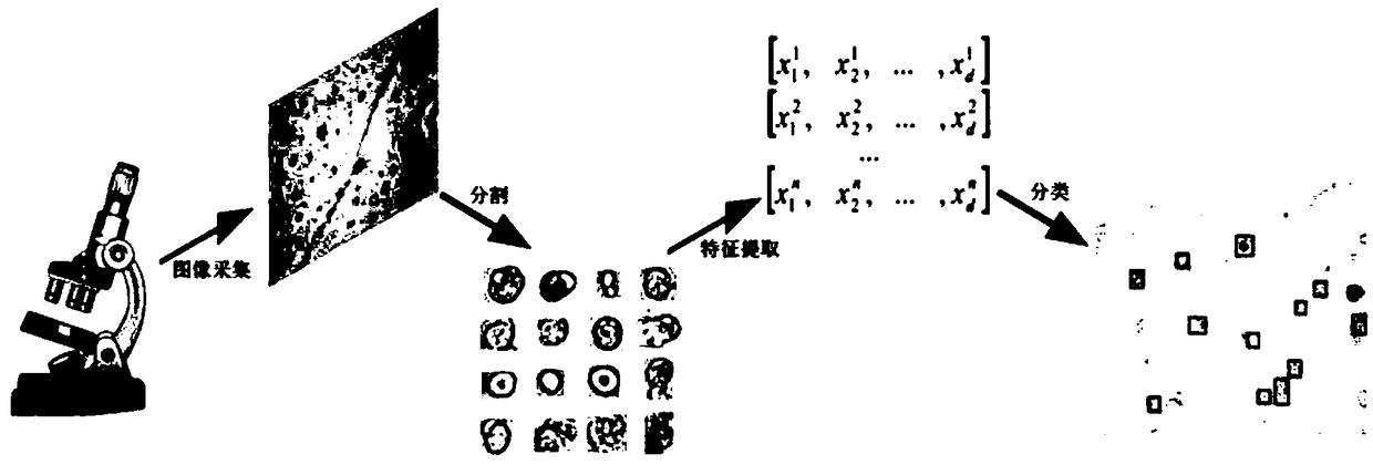 Method for automatically identifying urinary sediment visible components based on Trimmed SSD