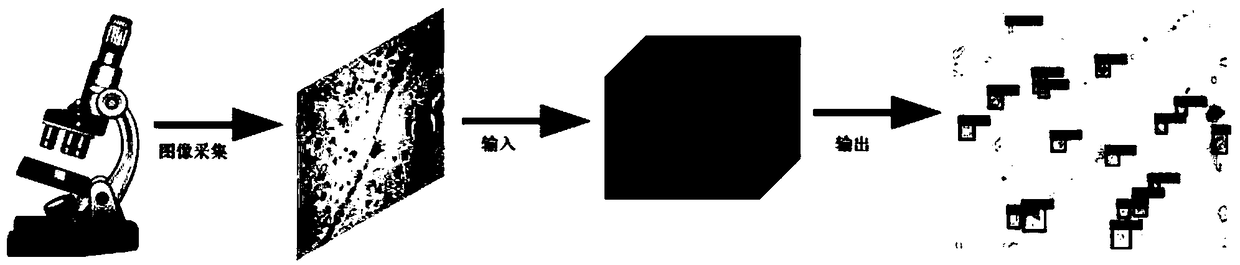 Method for automatically identifying urinary sediment visible components based on Trimmed SSD