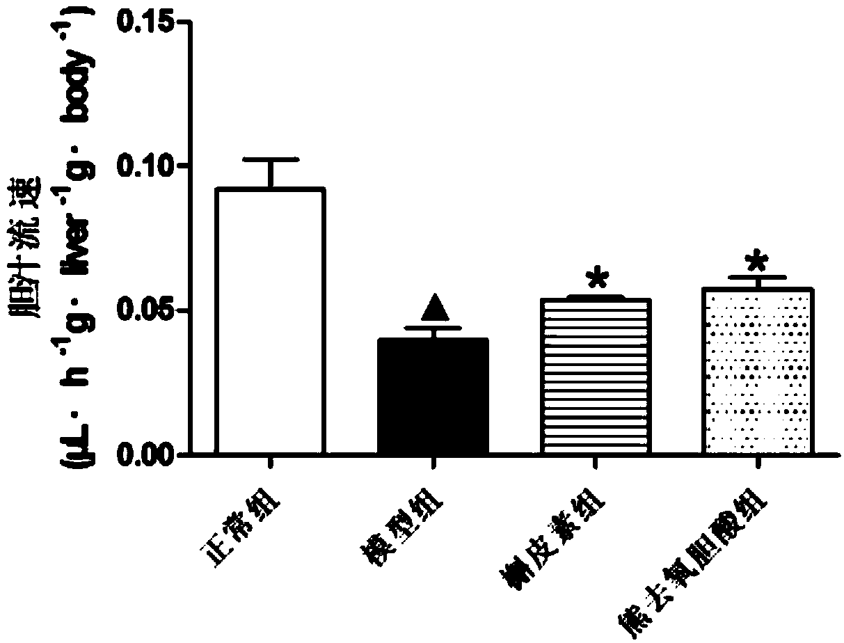 Application of quercetin in preparing product for treating cholestasis