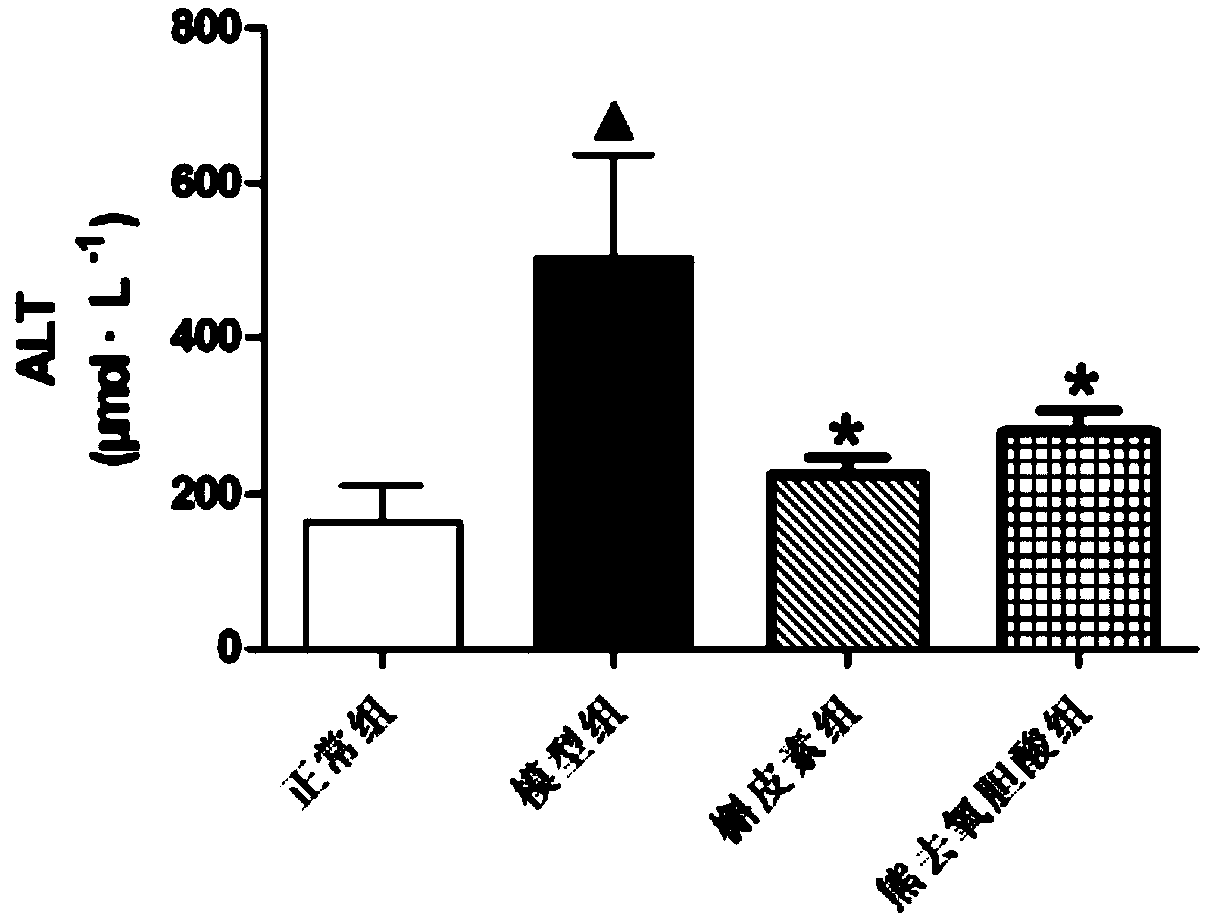 Application of quercetin in preparing product for treating cholestasis