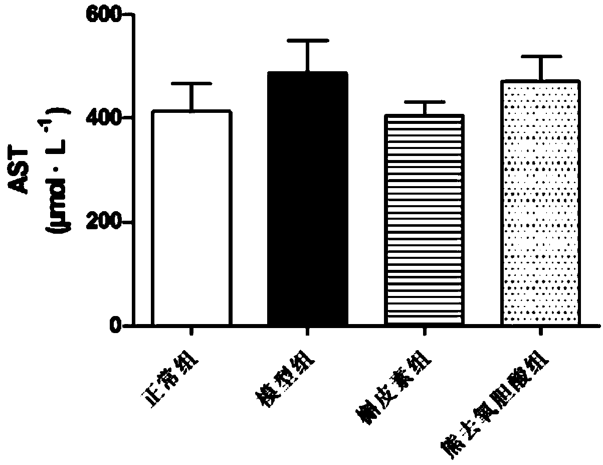 Application of quercetin in preparing product for treating cholestasis