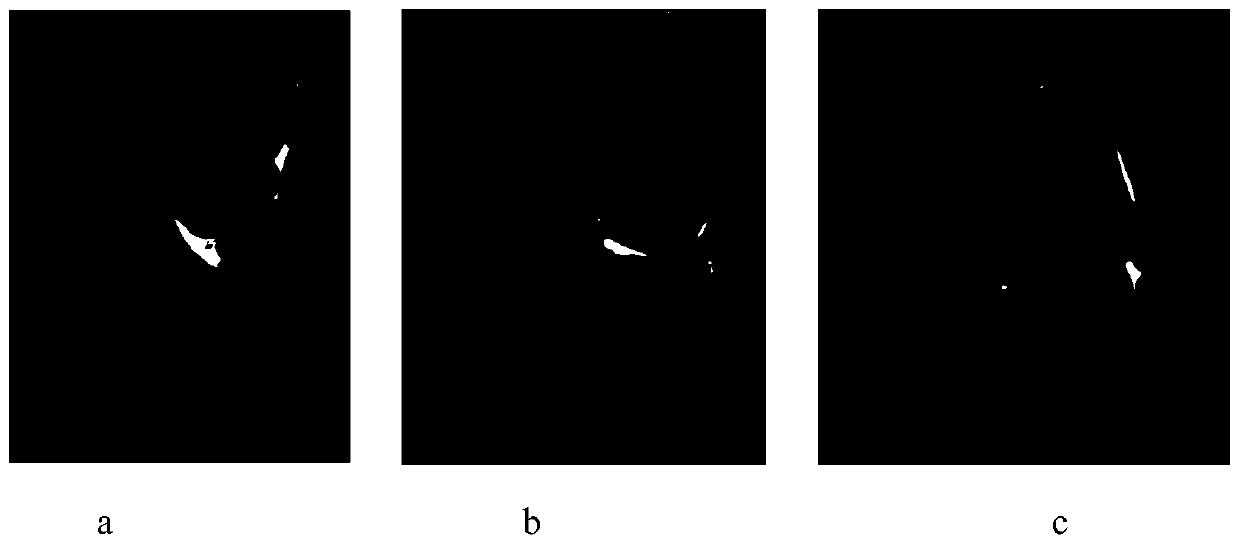 A virtual model construction method for unicompartmental knee arthroplasty based on point-to-point registration technology