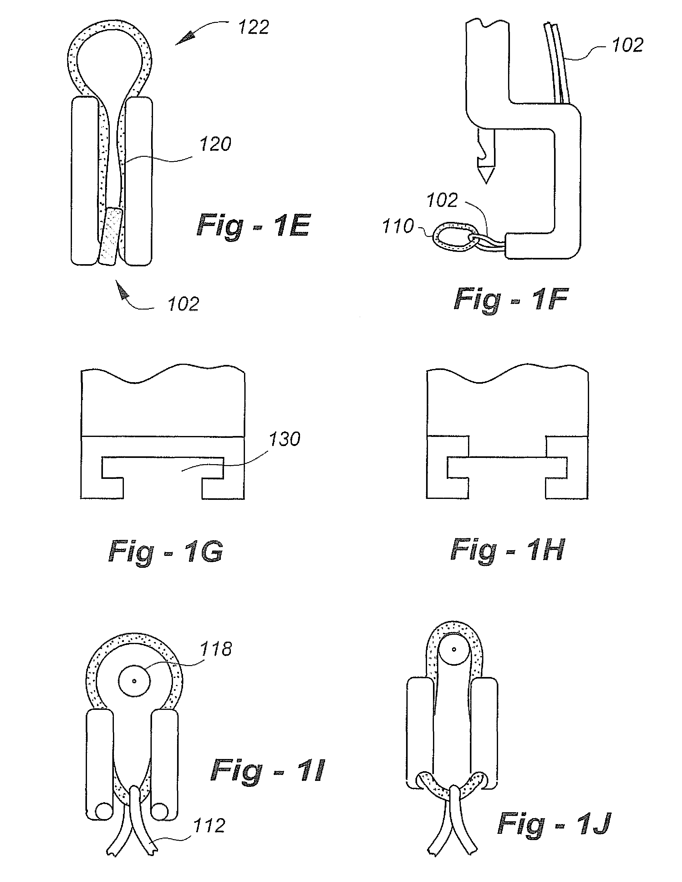 Intervertebral disc treatment methods and apparatus