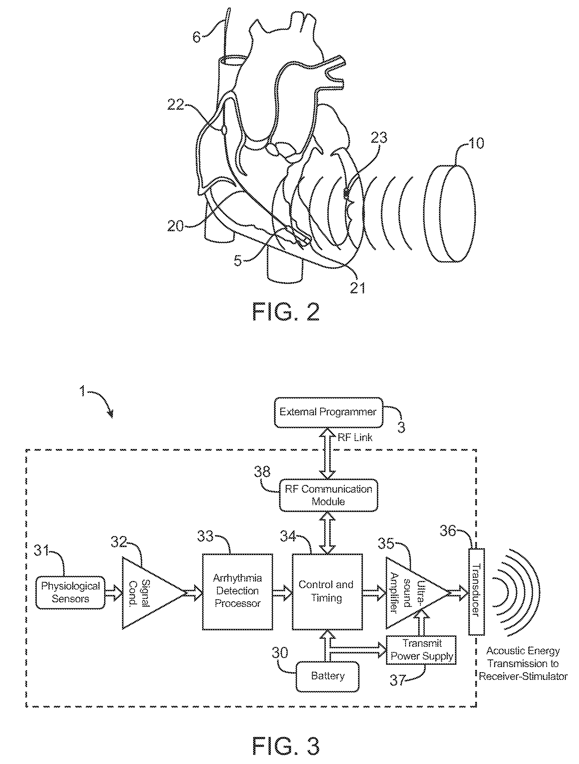 Acoustically-powered wireless defibrillator