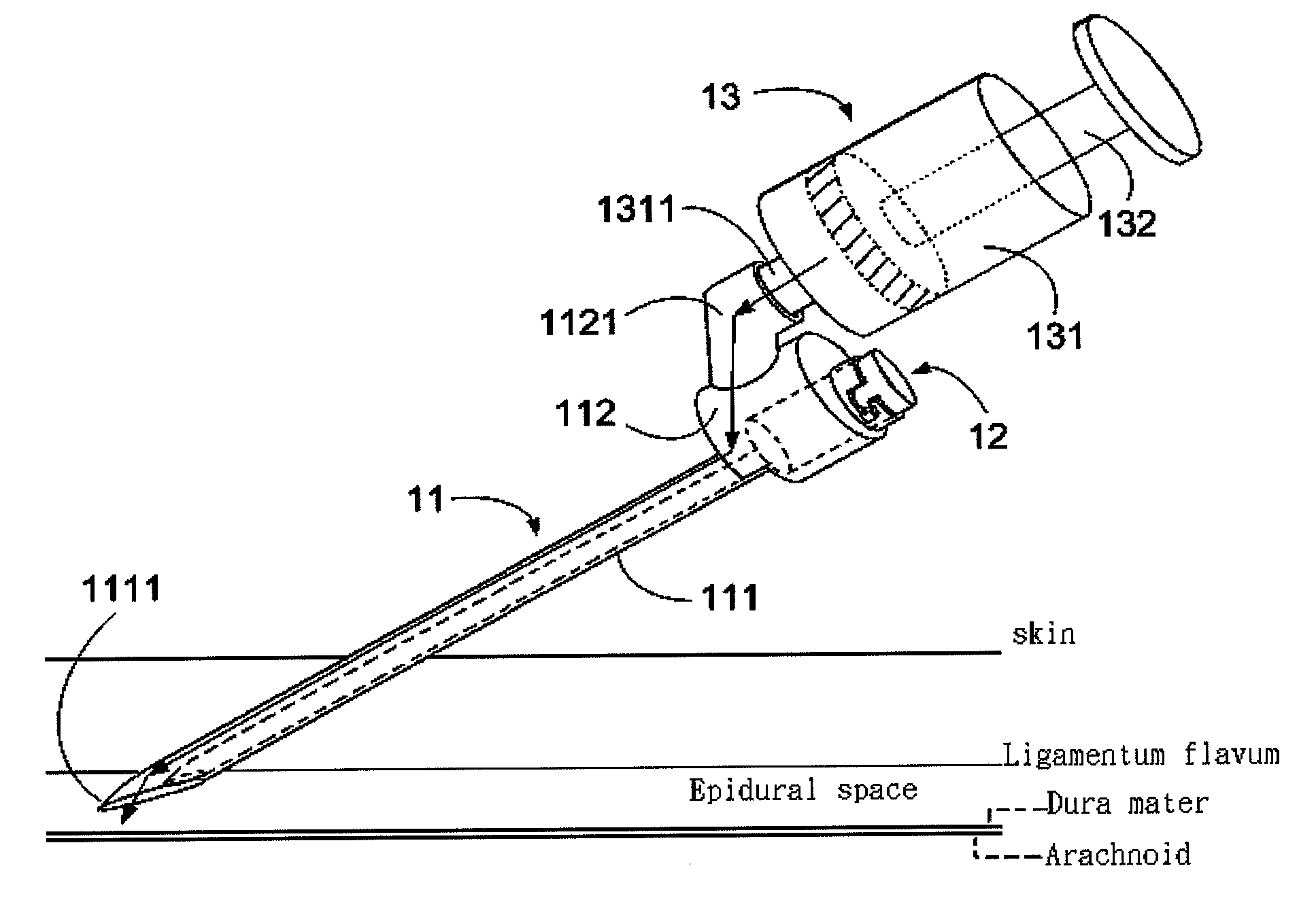 Ultrasonic positioning device for epidural space and method using the same