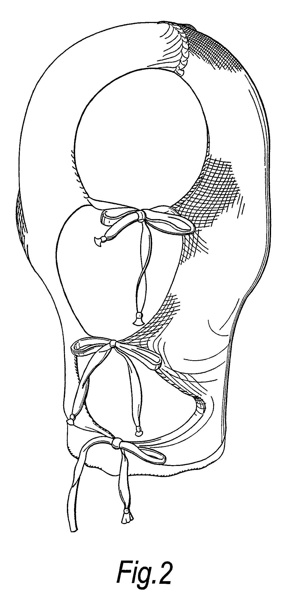 Carboxymethylated cellulosic wound dressing garment