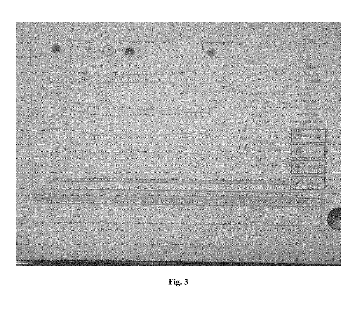 Remote View Playback Tool