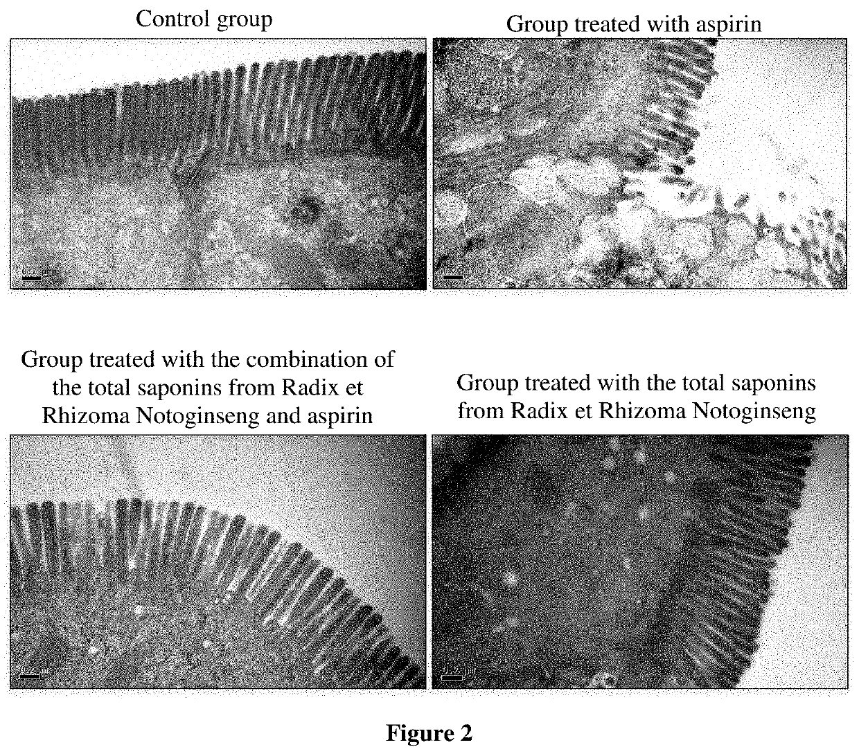 Novel use of combination or composition of panax notoginseng and aspirin