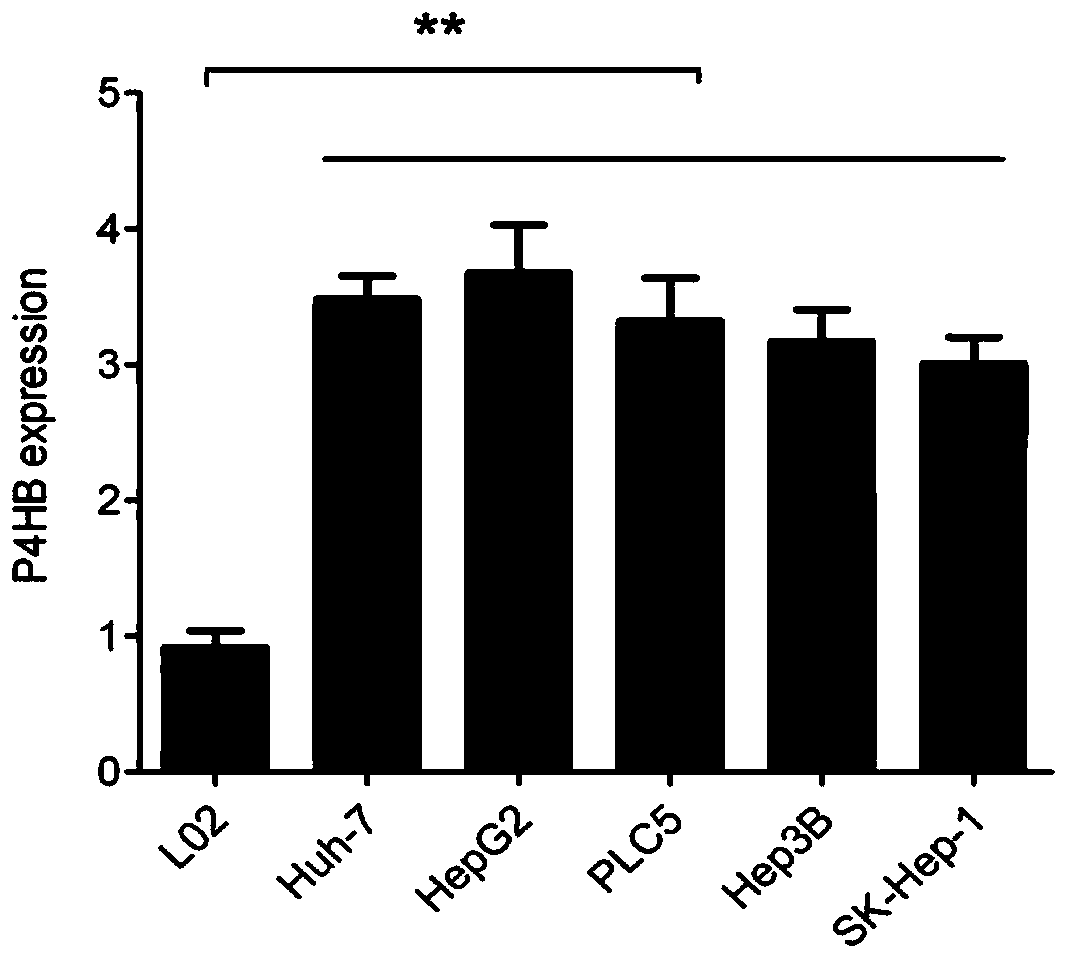 A kind of inhibitor of p4hb gene expression and its application