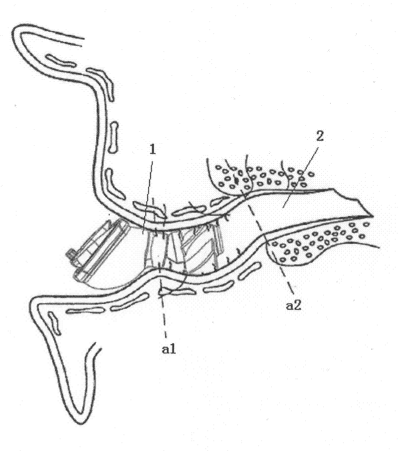 A general-purpose hinged in-ear hearing aid