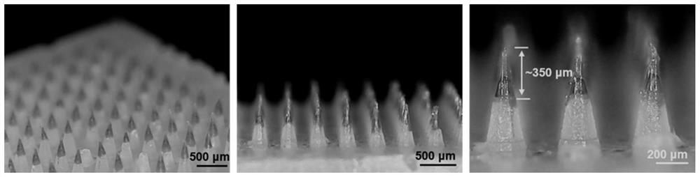 Microneedle patch loaded with copper ion doped polydopamine as well as preparation method and application of microneedle patch