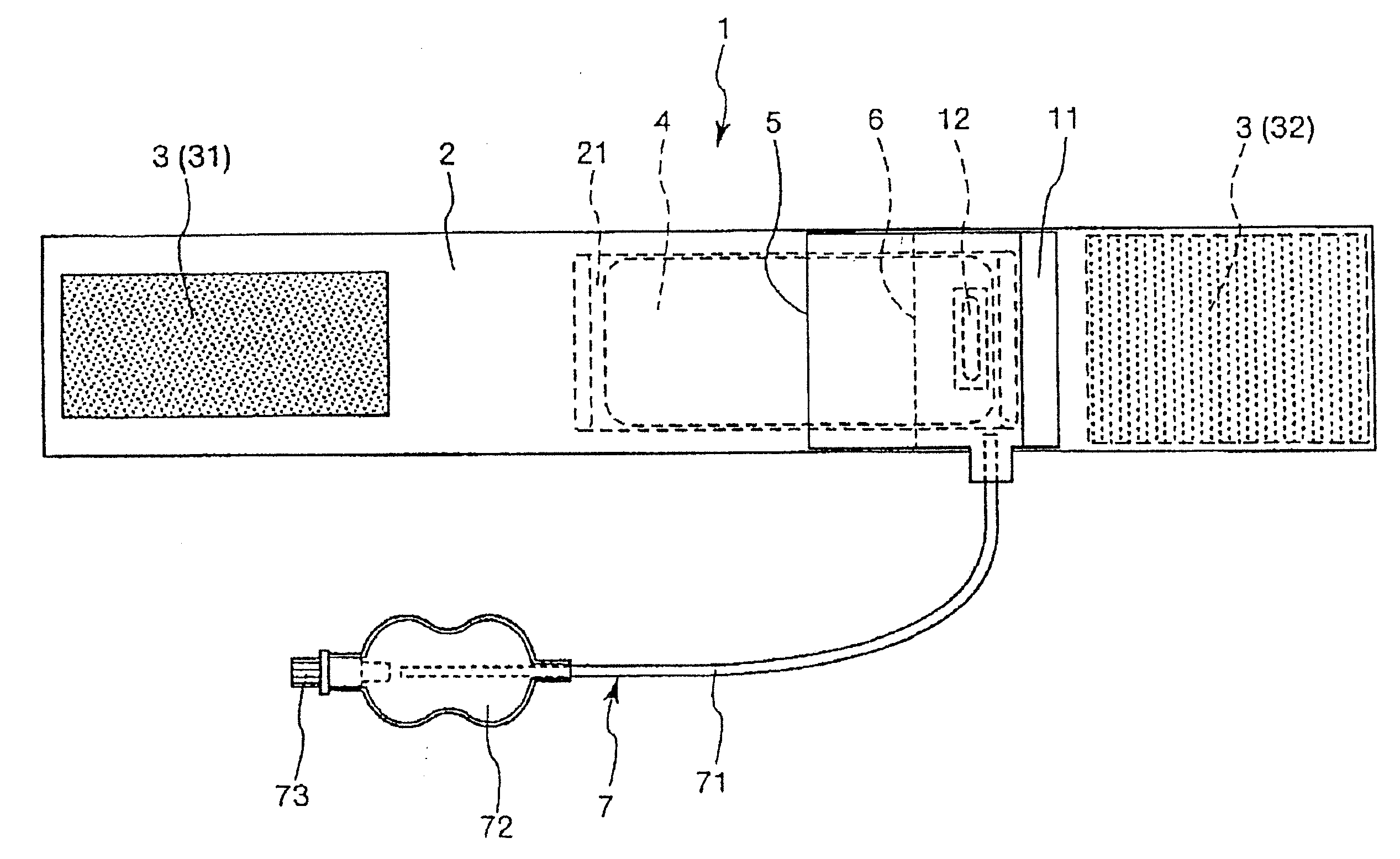 Method to stop bleeding at a puncture site of an artery of a patient's wrist