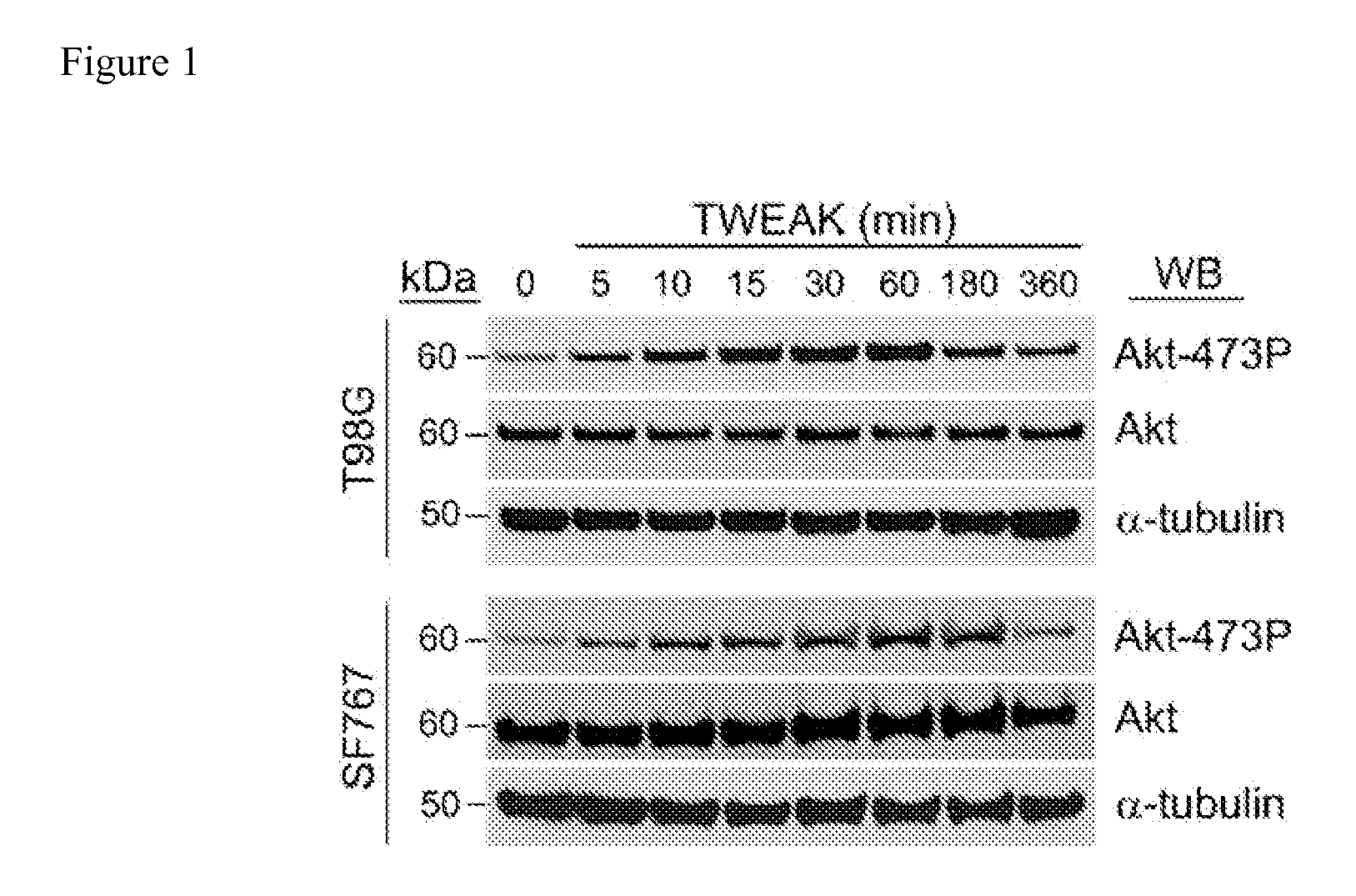 Methods and kits used in identifying glioblastoma