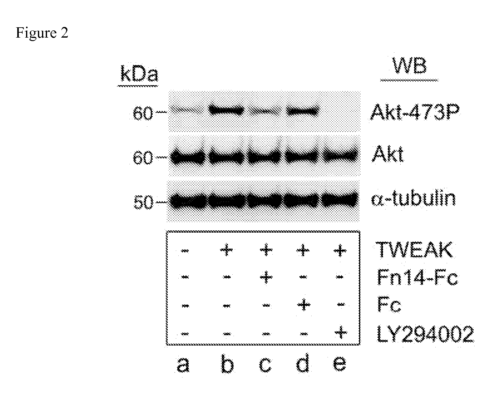 Methods and kits used in identifying glioblastoma