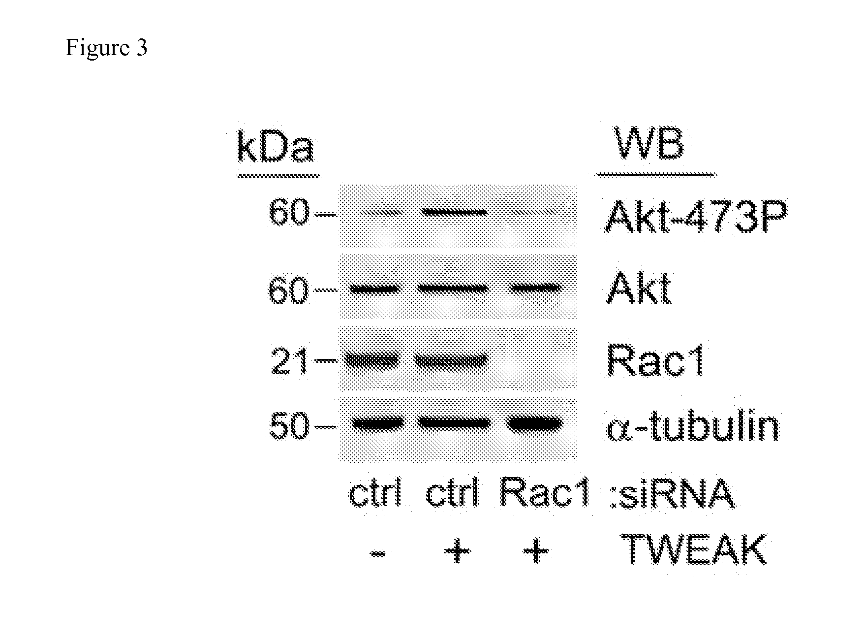 Methods and kits used in identifying glioblastoma