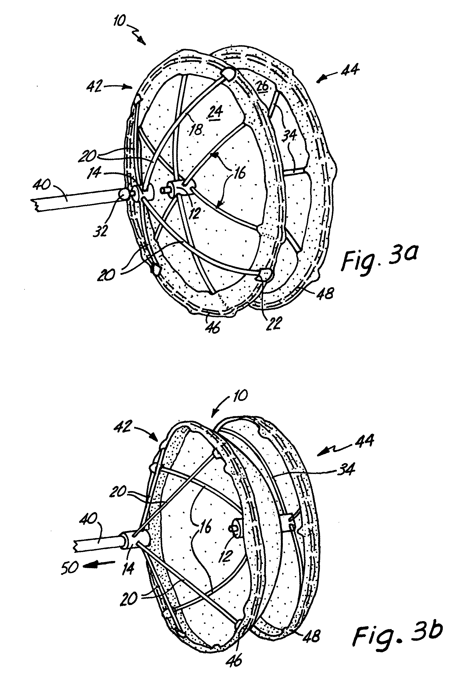 Right retrieval mechanism