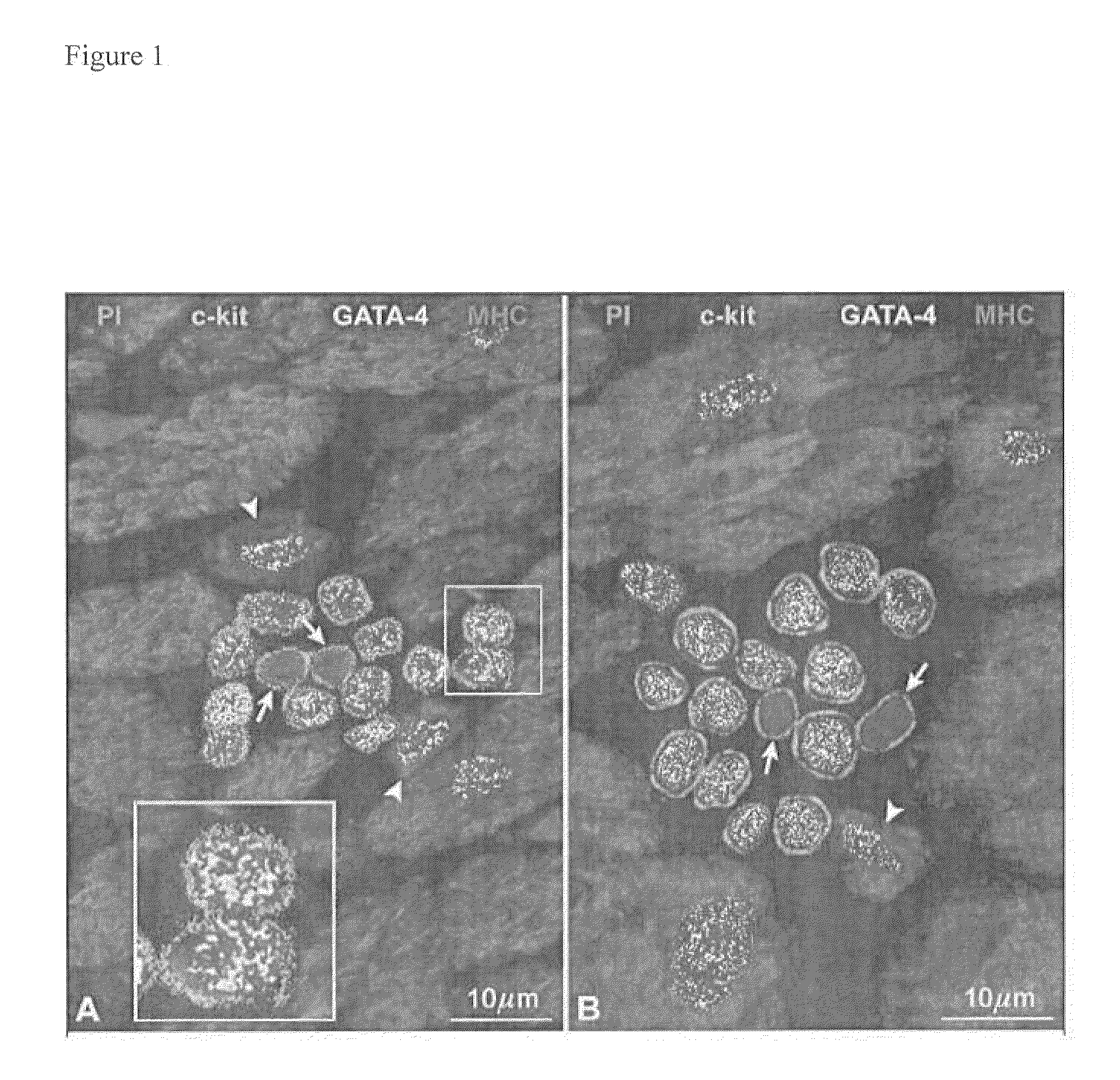 Methods of isolating non-senescent cardiac stem cells and uses thereof