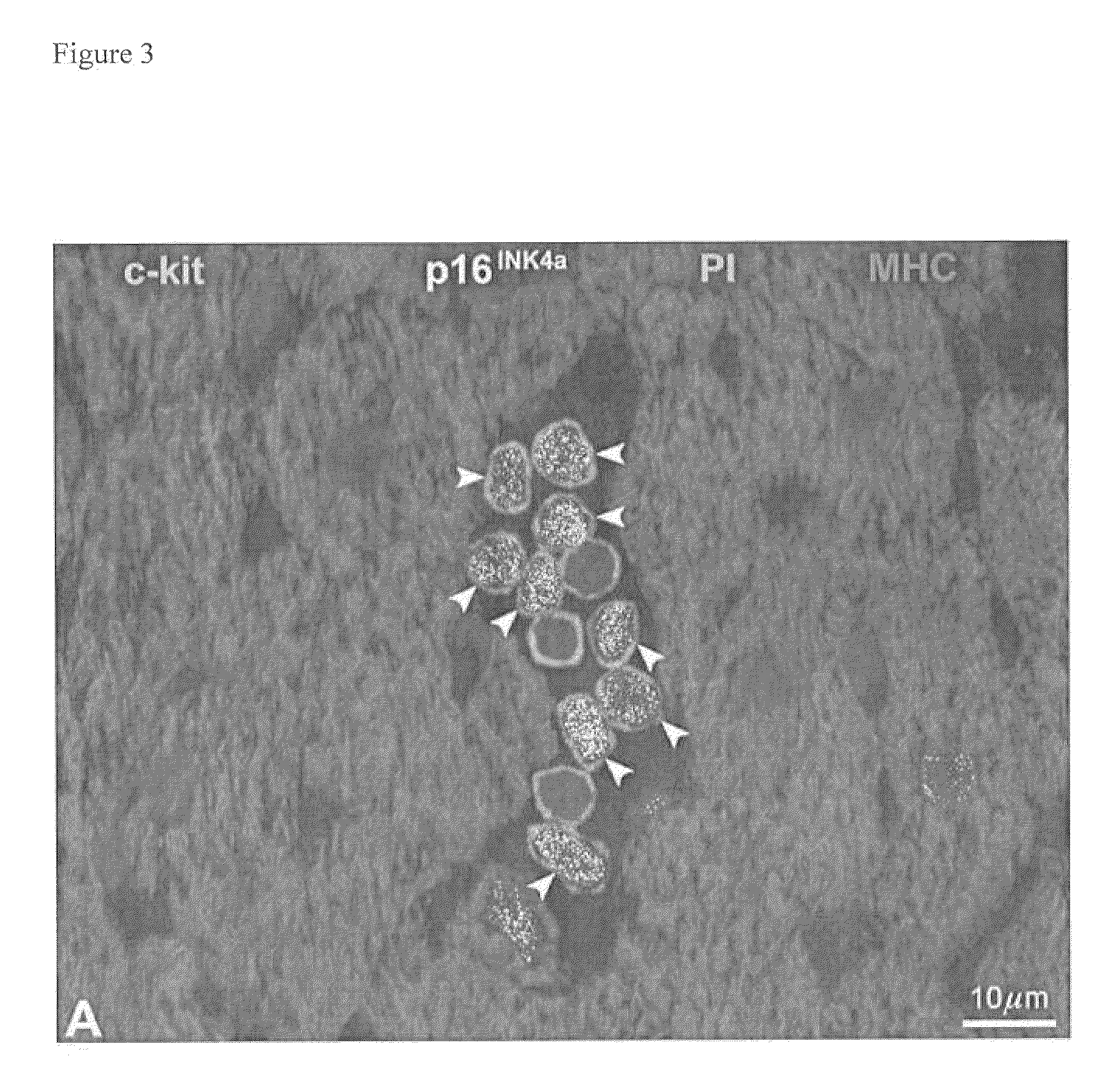 Methods of isolating non-senescent cardiac stem cells and uses thereof